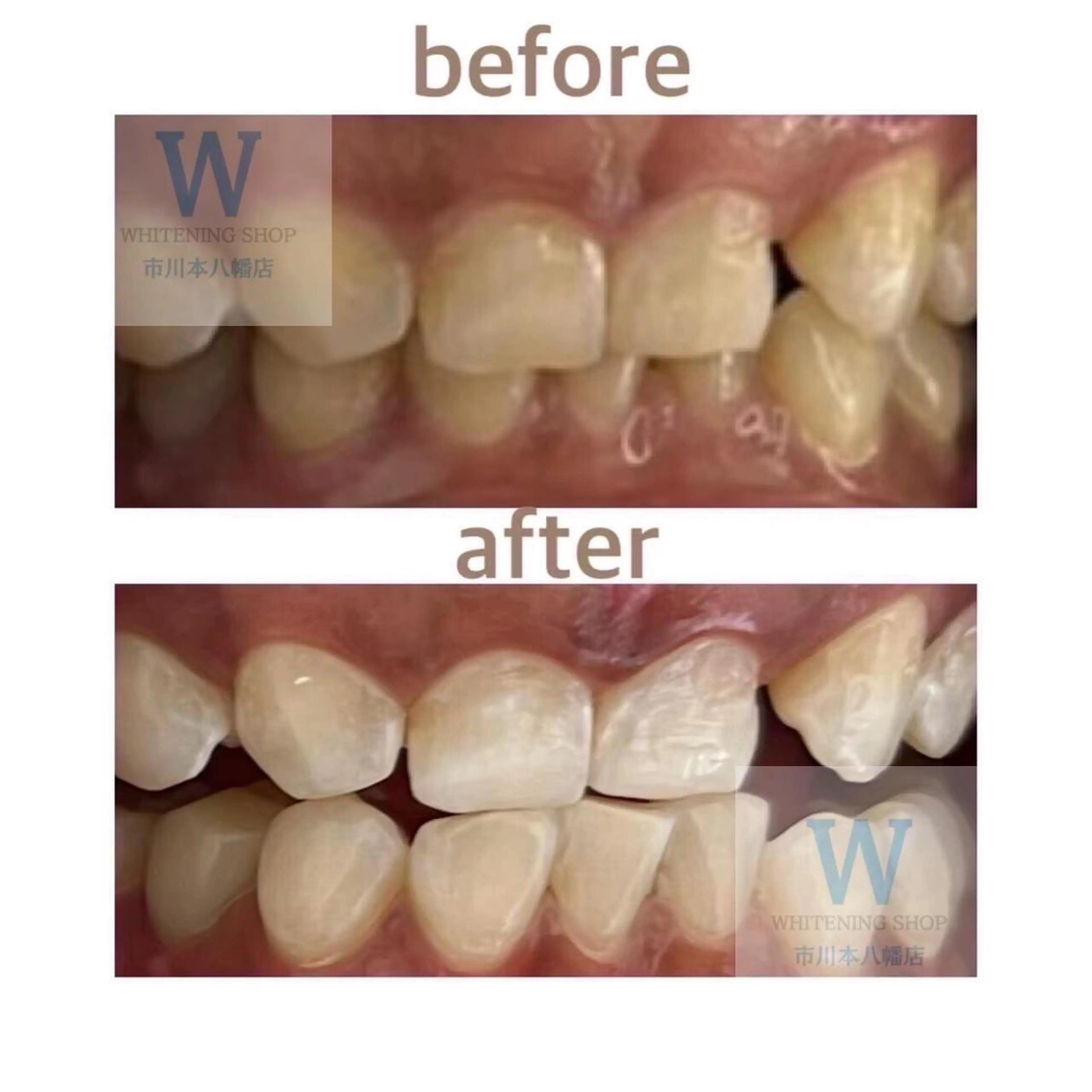 ホワイトニング ショップ本八幡店のエステ・リラクイメージ