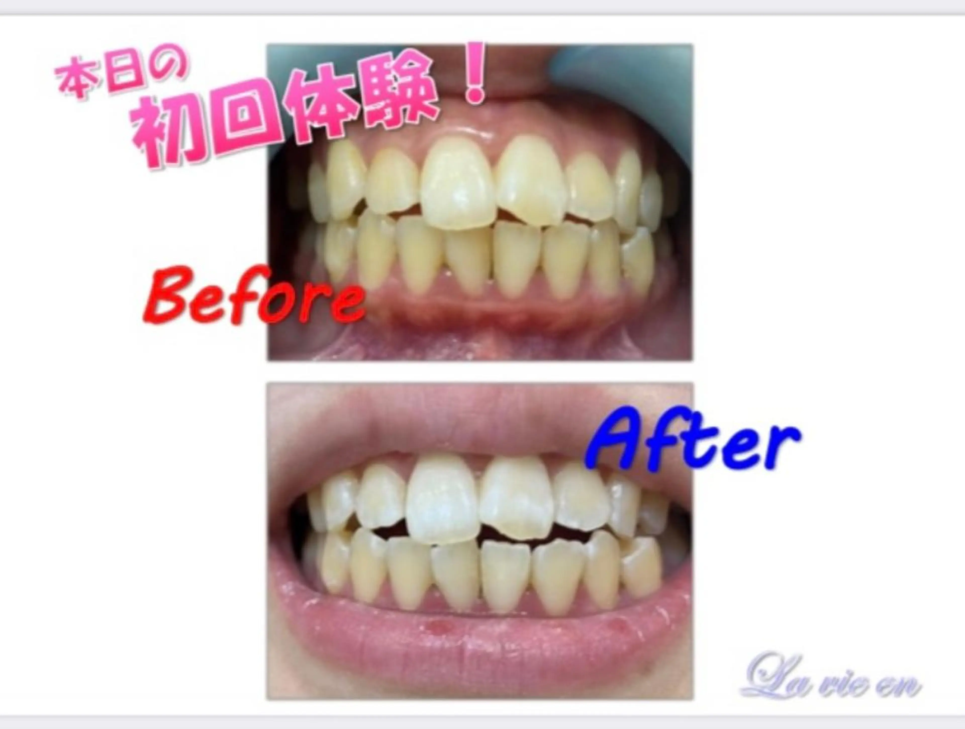 その他 セルフホワイトニングサロン　ラヴィアン所属・ホワイトニングサロン La vie enのその他イメージ