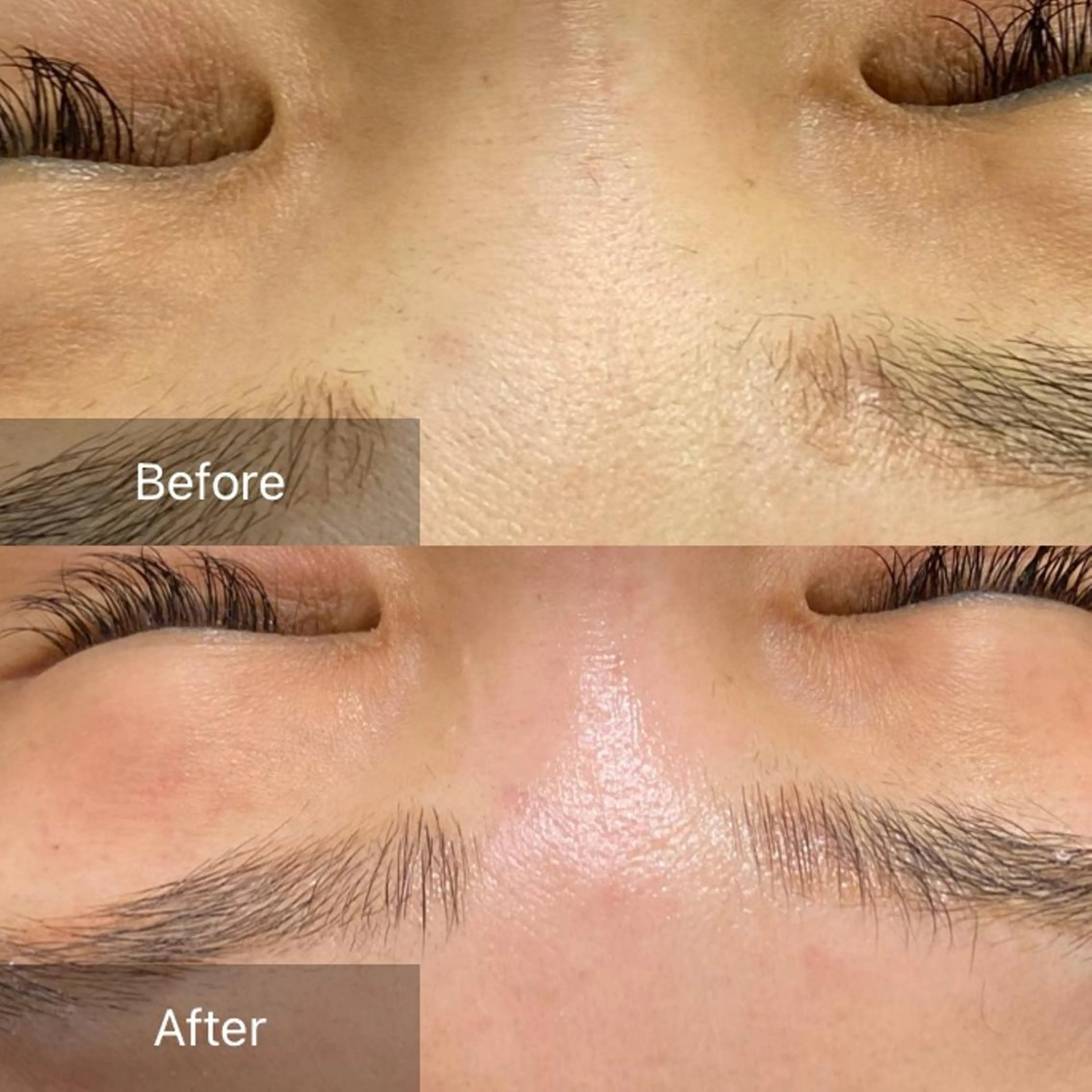 脱毛 産毛専門店 Bittoのエステ・リラクイメージ