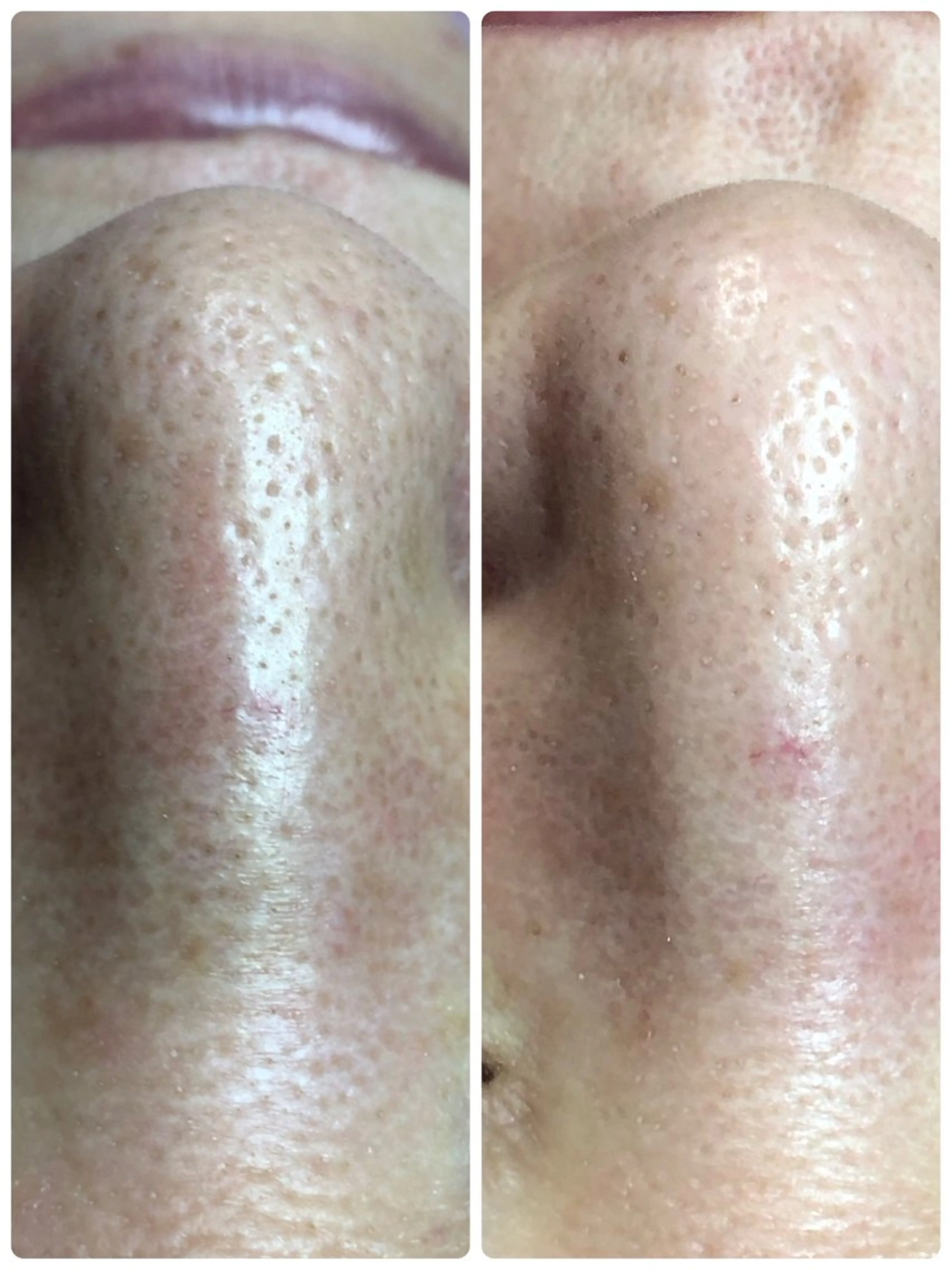 private salon  Dea_maris シュガーリング＆パーソナルボディケア所属・シミ改善・韓国肌管理 ボディメイク痩身のその他イメージ