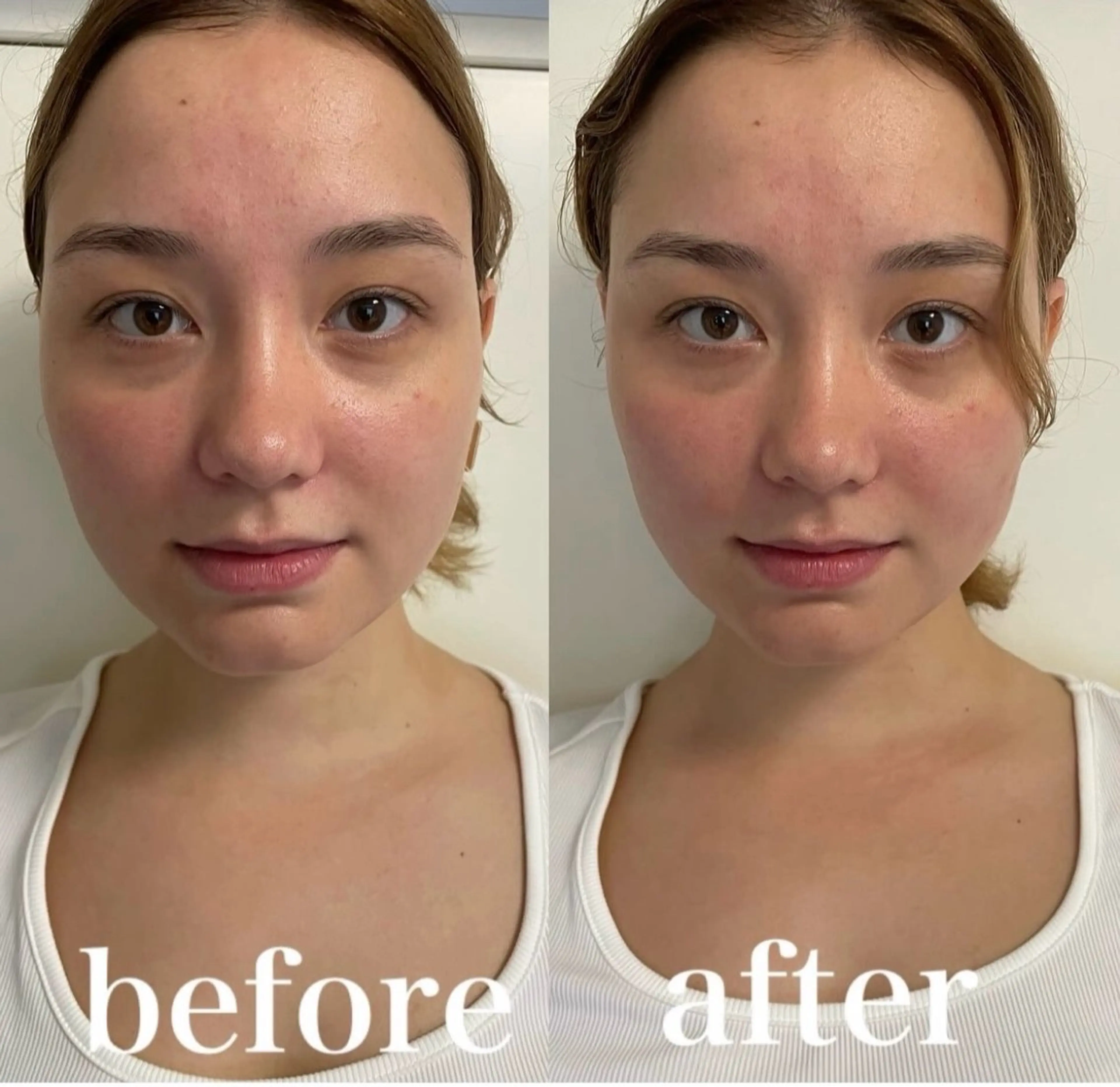 エステ リラク 美容鍼灸サロン mahoroba院長のエステ・リラクイメージ