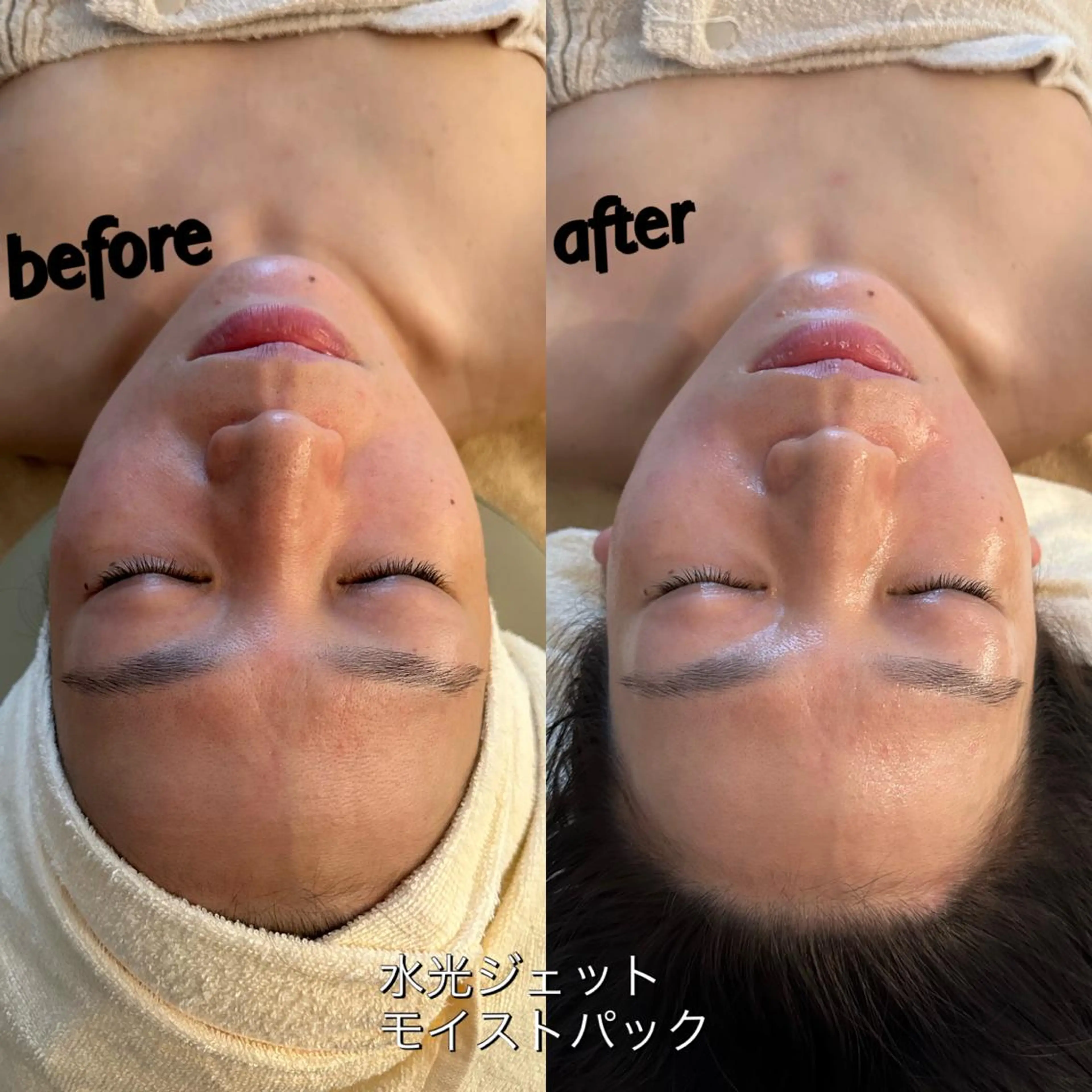 うなじ脱毛/美肌脱毛 LABELのエステ・リラクイメージ