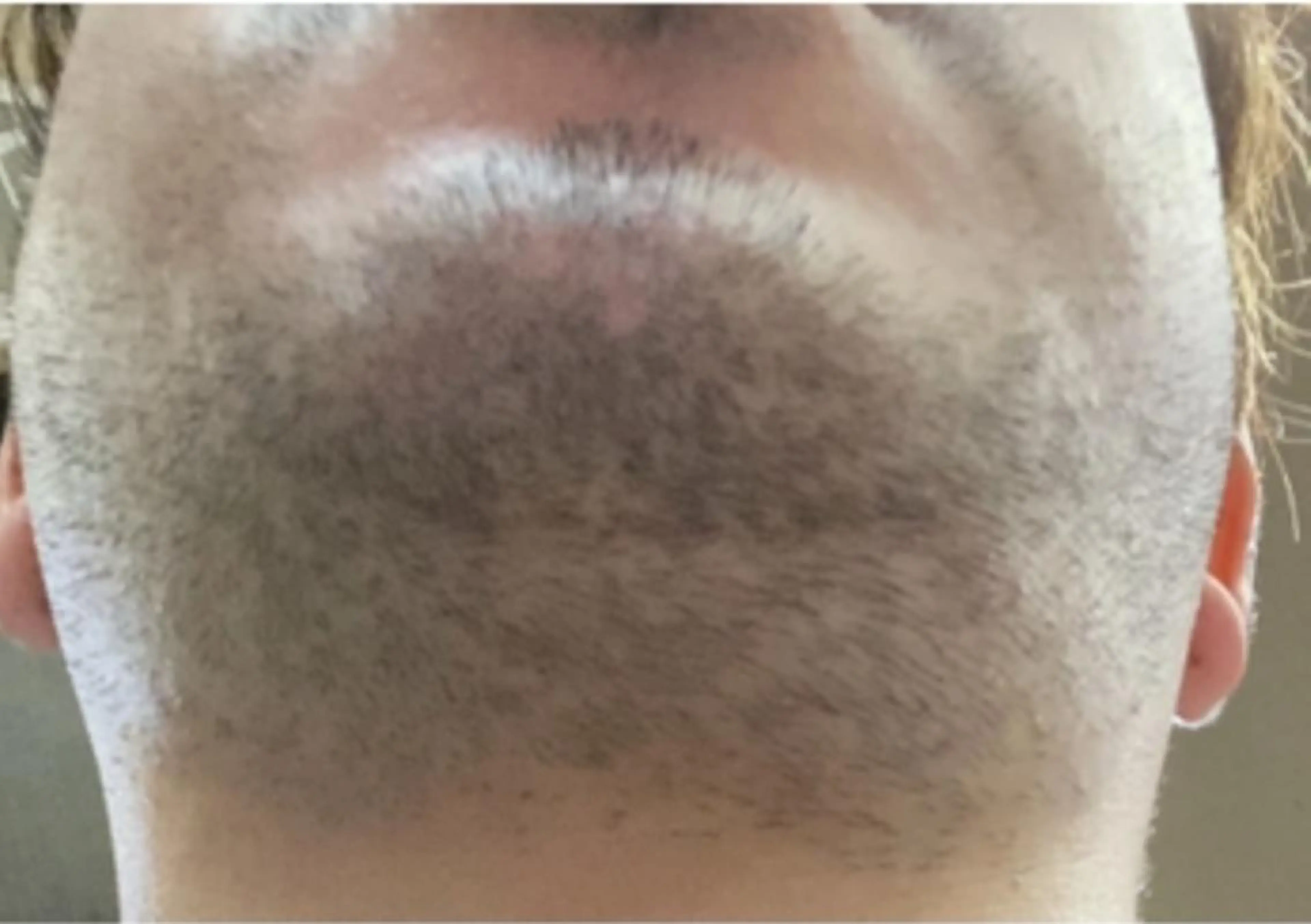 ATRIUM　 HOMMEのエステ・リラクイメージ