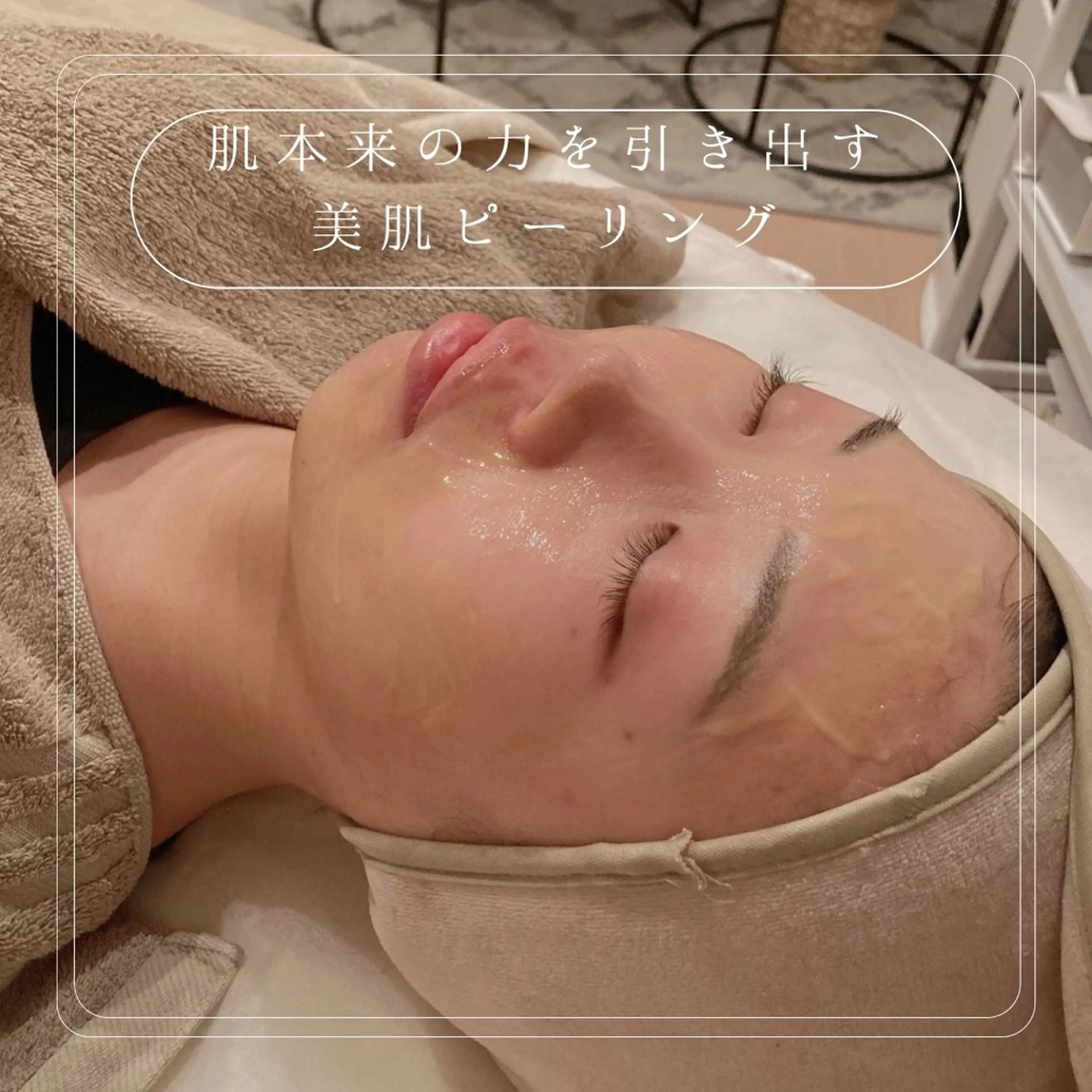 【美肌ピーリング🌿🌿🌿】ニキビ、たるみ、シワ、シミに効果的✨今あるトラブルを改善❣️肌質を変えたい方はこちら☝️の写真