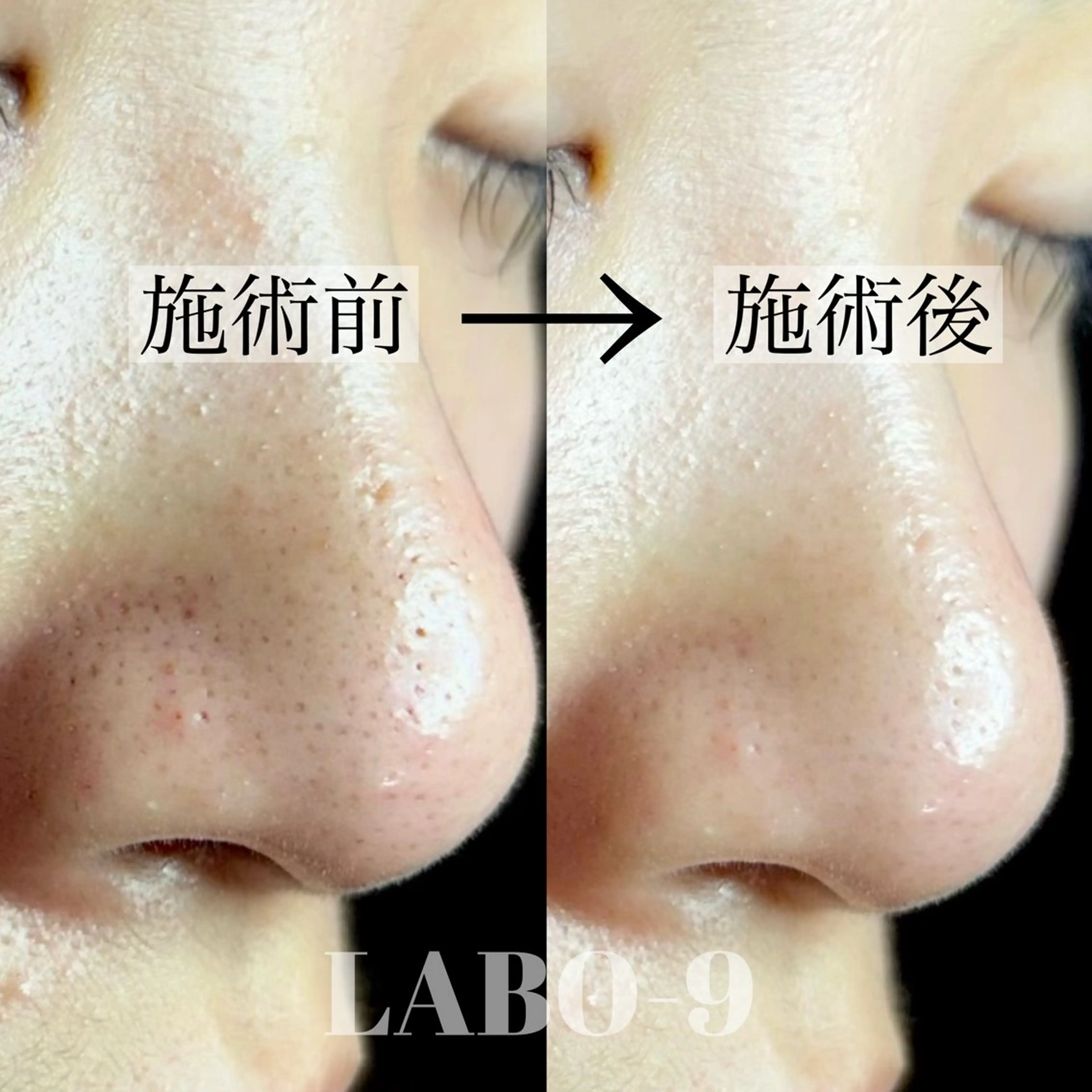 エステ LABO-9所属・田中 捺未のエステ・リラクイメージ