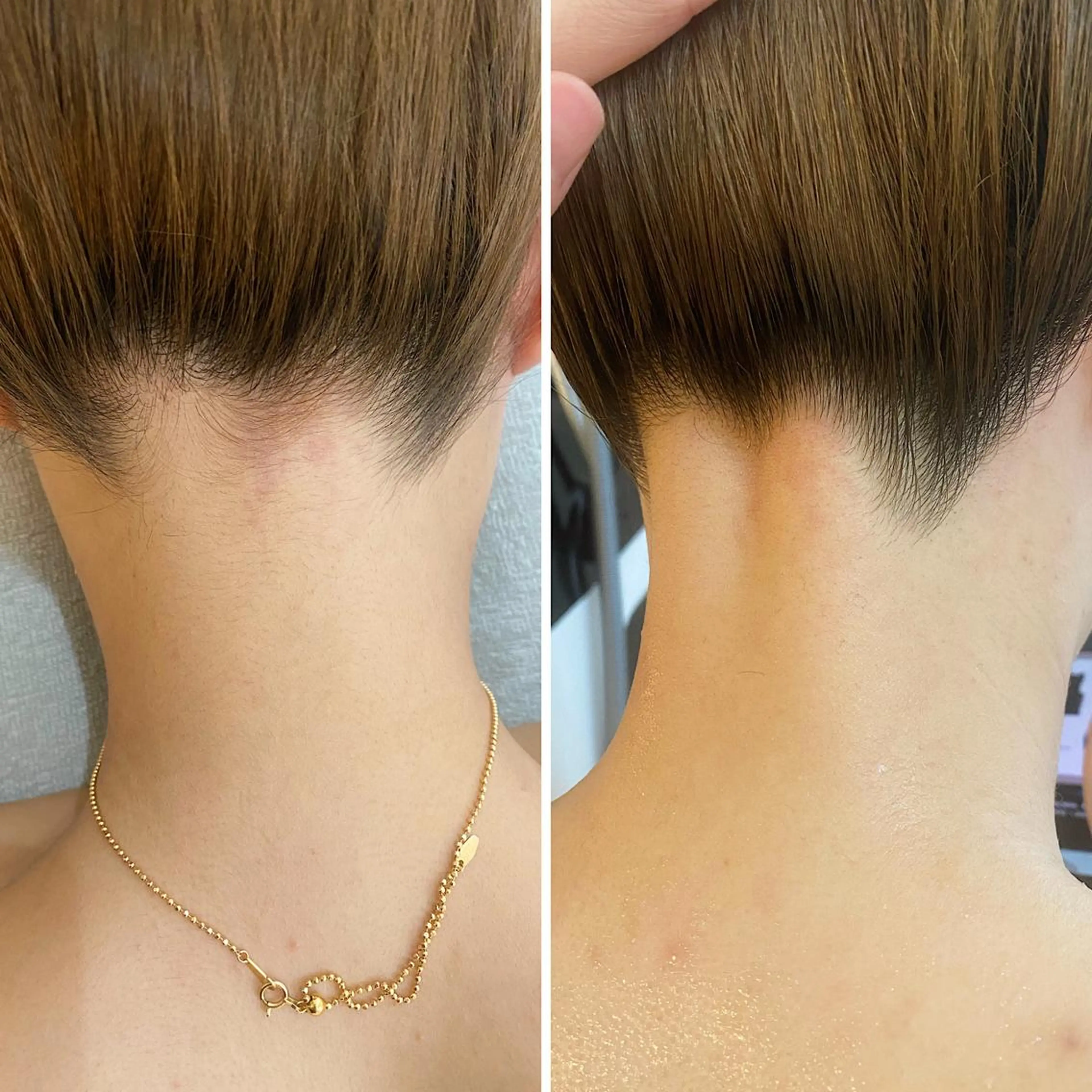 うなじ脱毛/美肌脱毛 LABELのエステ・リラクイメージ