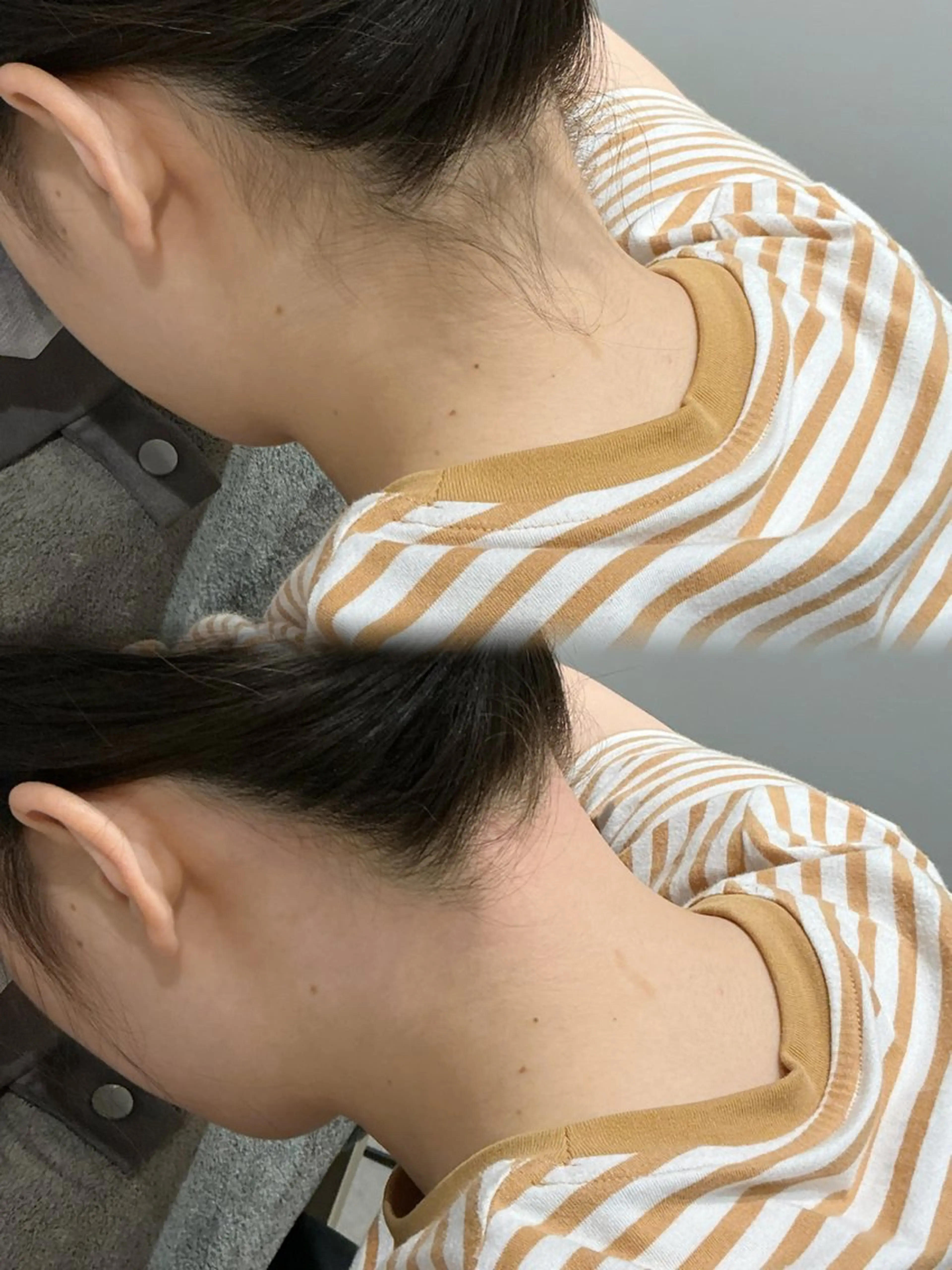 脱毛 脱毛サロンBloom所属・脱毛屋さん/池袋 /Bloom🍋わだのエステ・リラクイメージ