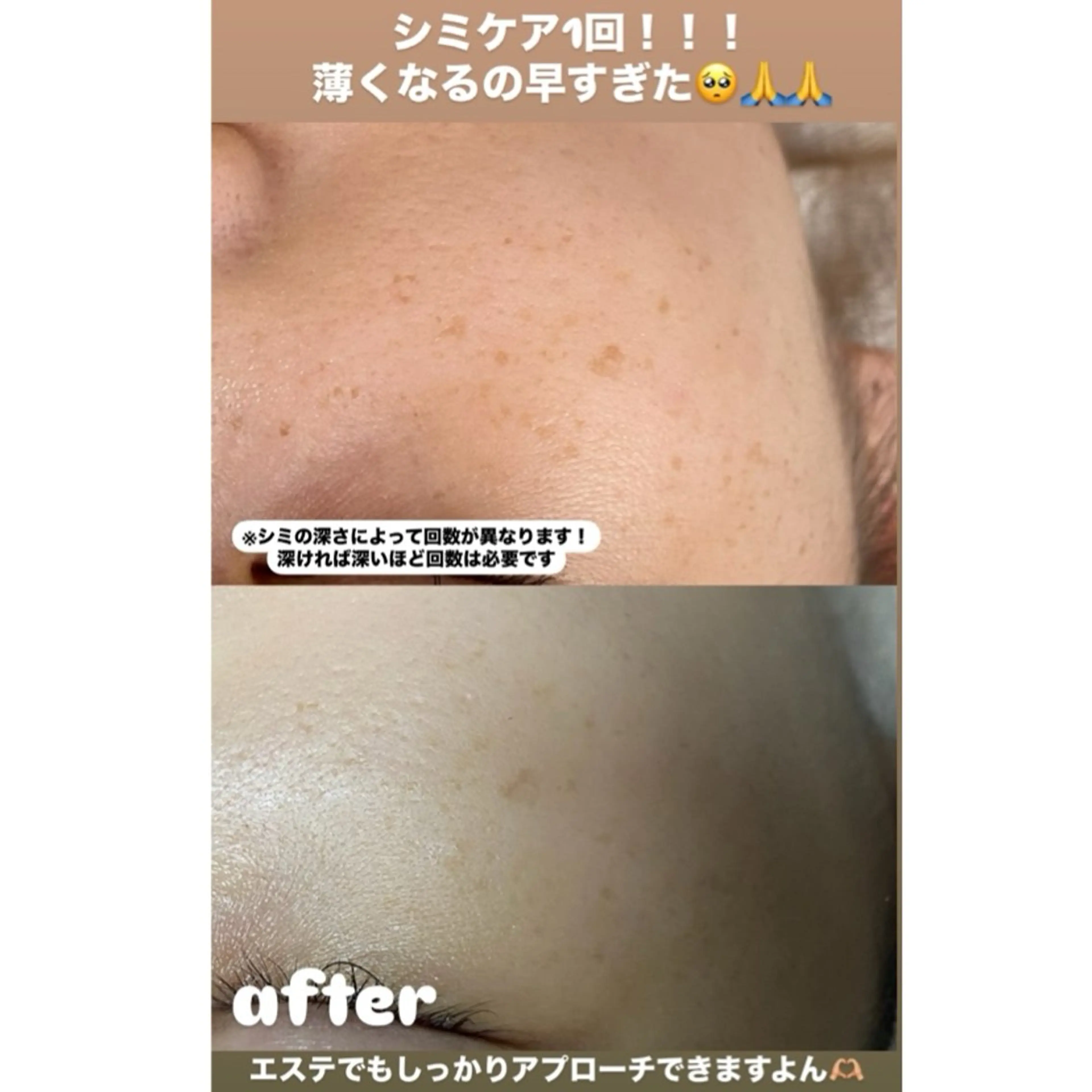 エステ Private salon Dux所属・肌管理&nail Salon  Duxの眉毛・アイブロウイメージ