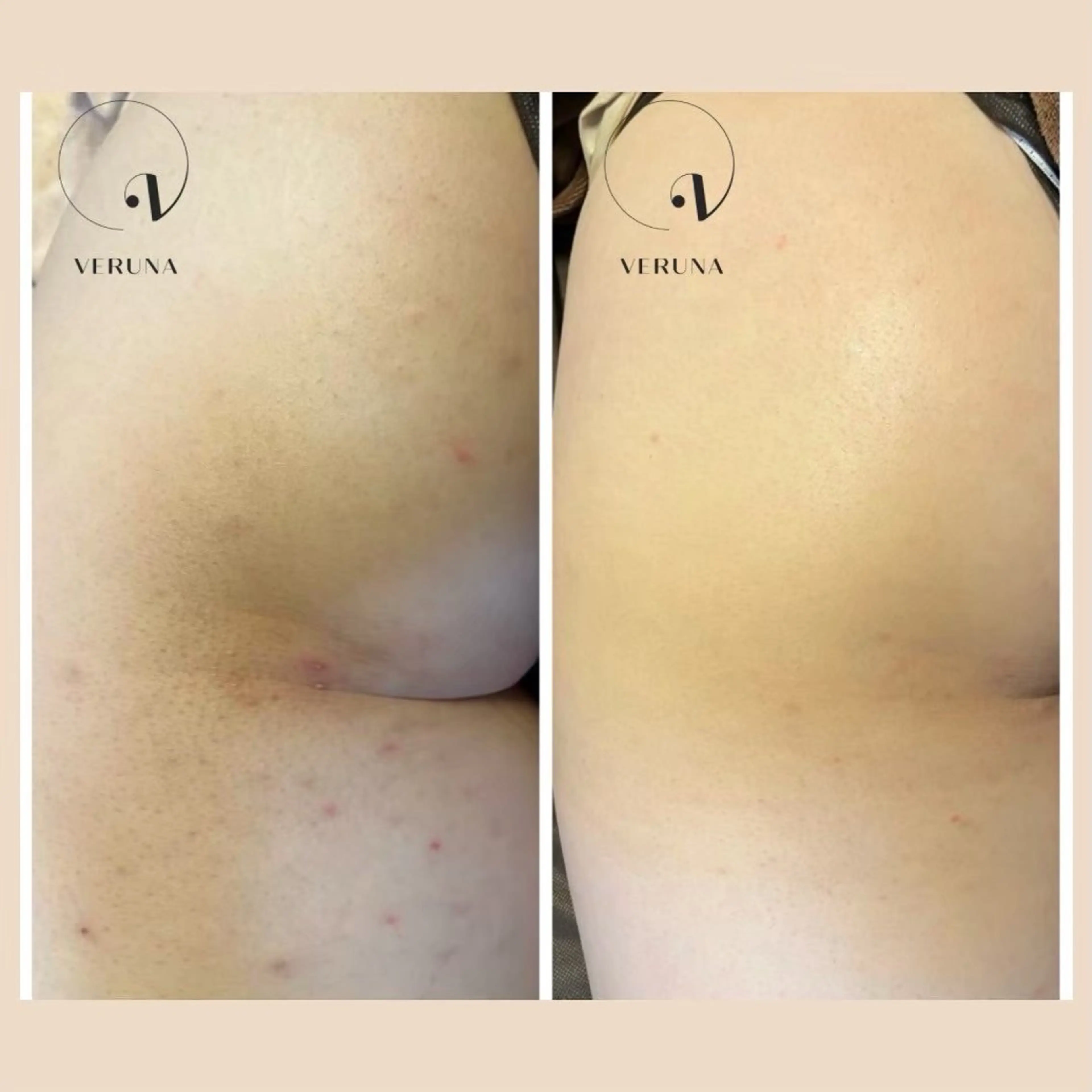 エステ ニキビ改善専門店 d'Albaのエステ・リラクイメージ