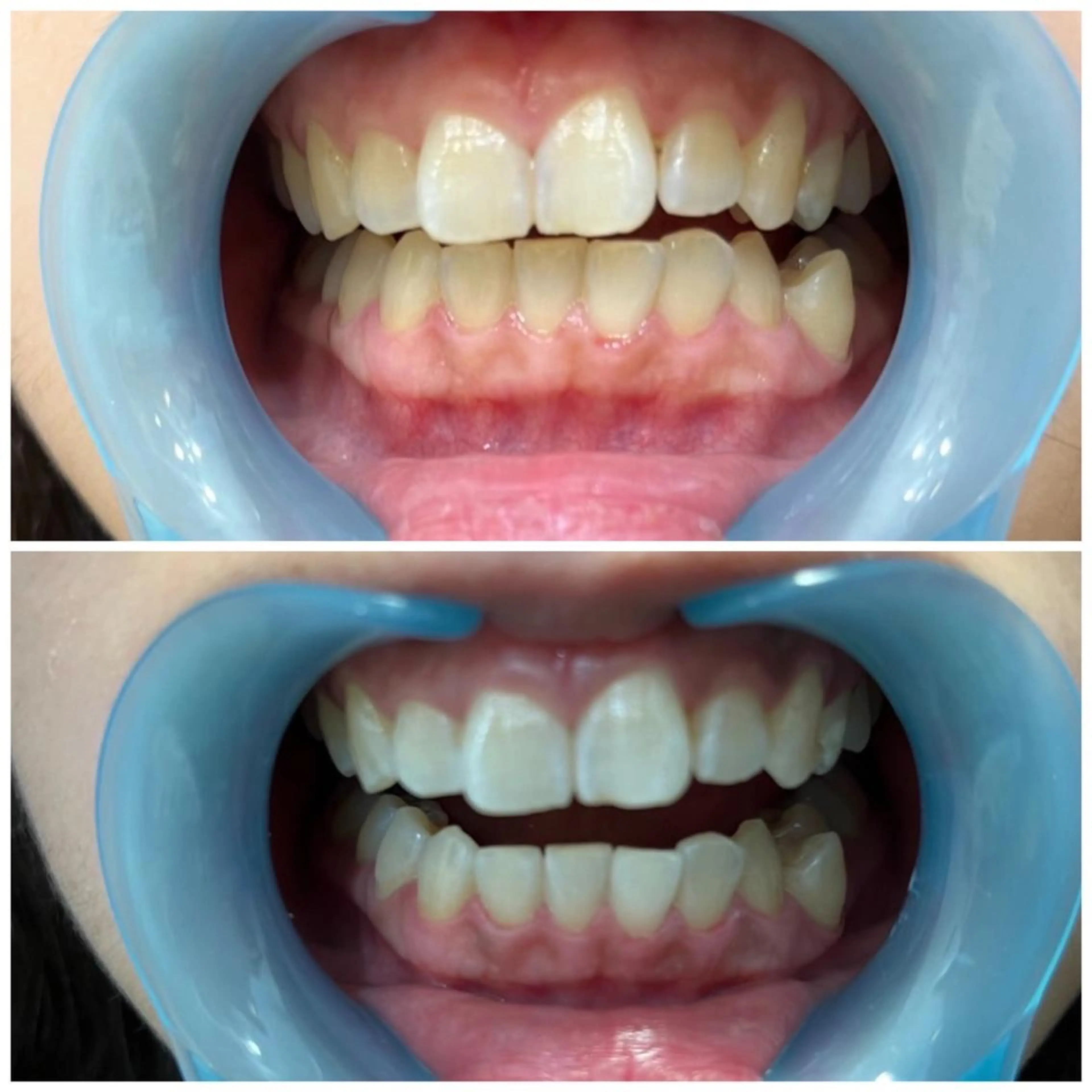 プライベートサロン Lｏｋａｈｉ飯生透のエステ・リラクイメージ