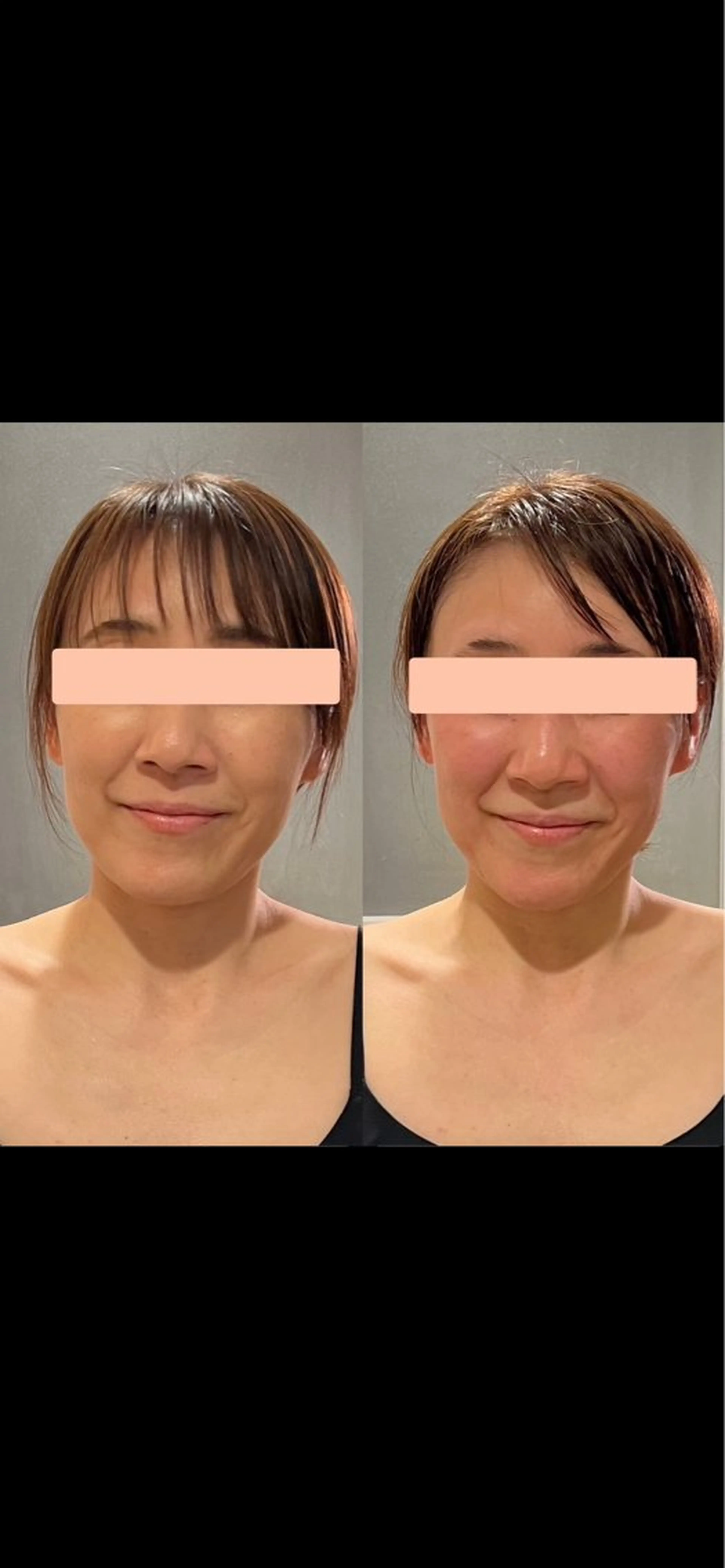 YOSAPARK sonoritéのエステ・リラクイメージ