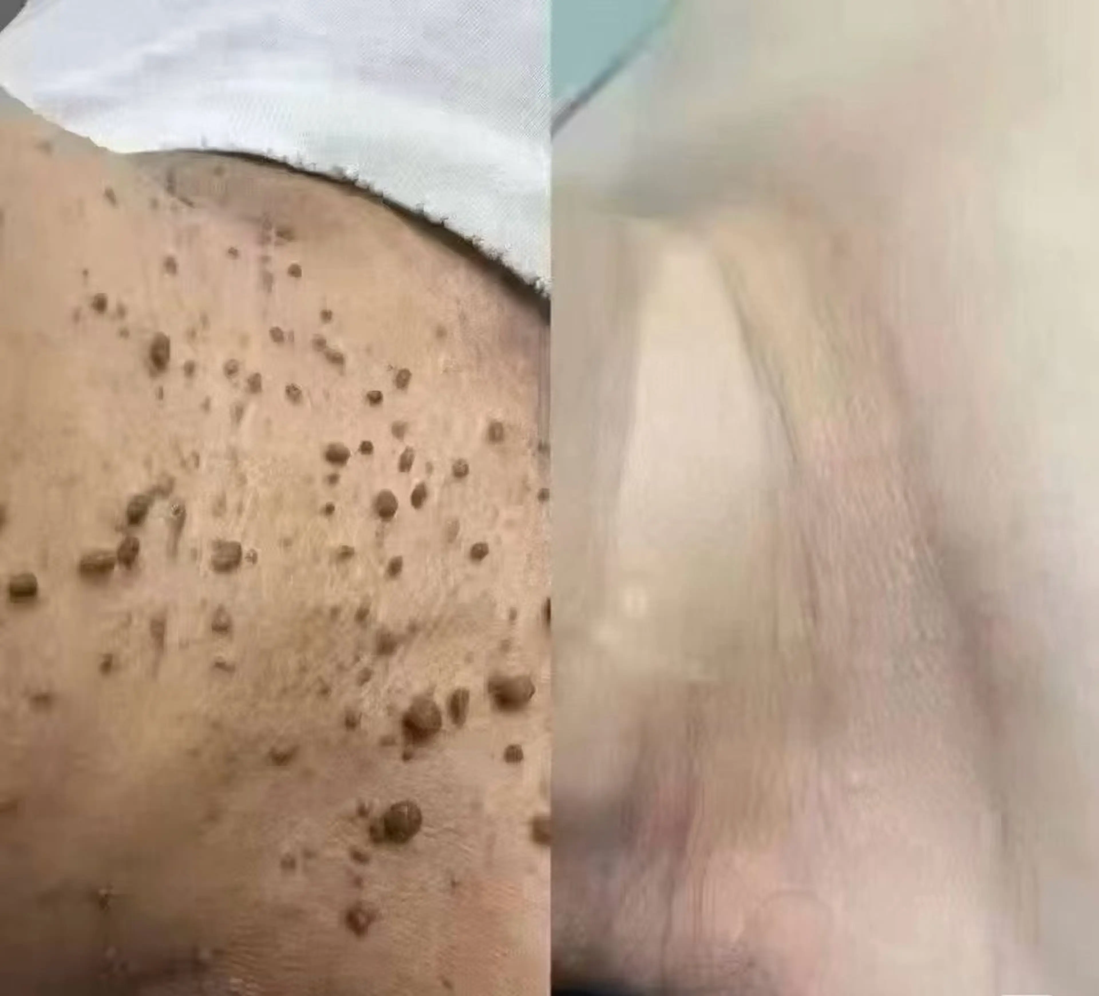 ビューティーリゾート麗所属・于 麗影のエステ・リラクイメージ