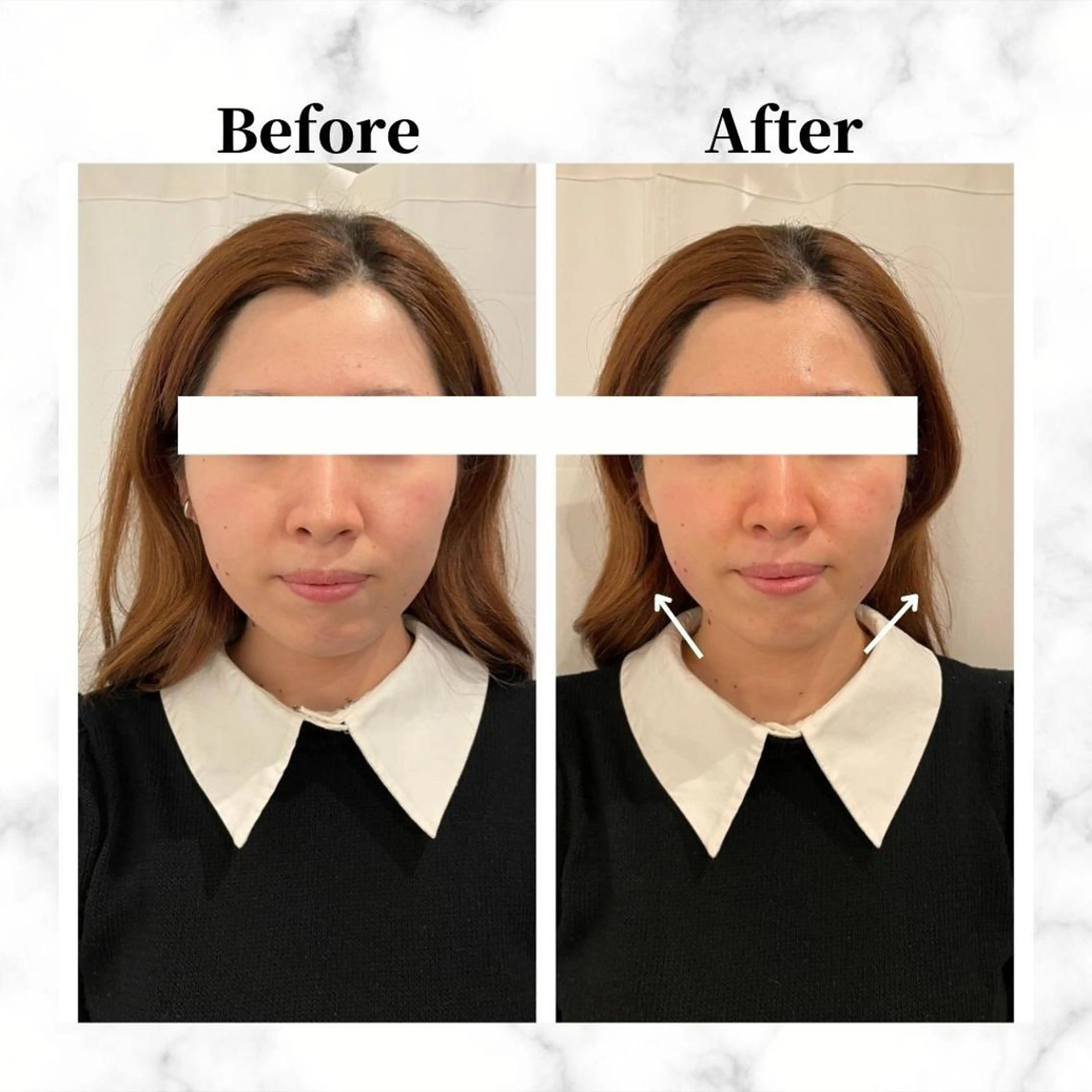 エステ リラク 12Dハイフ💗 最強小顔のエステ・リラクイメージ