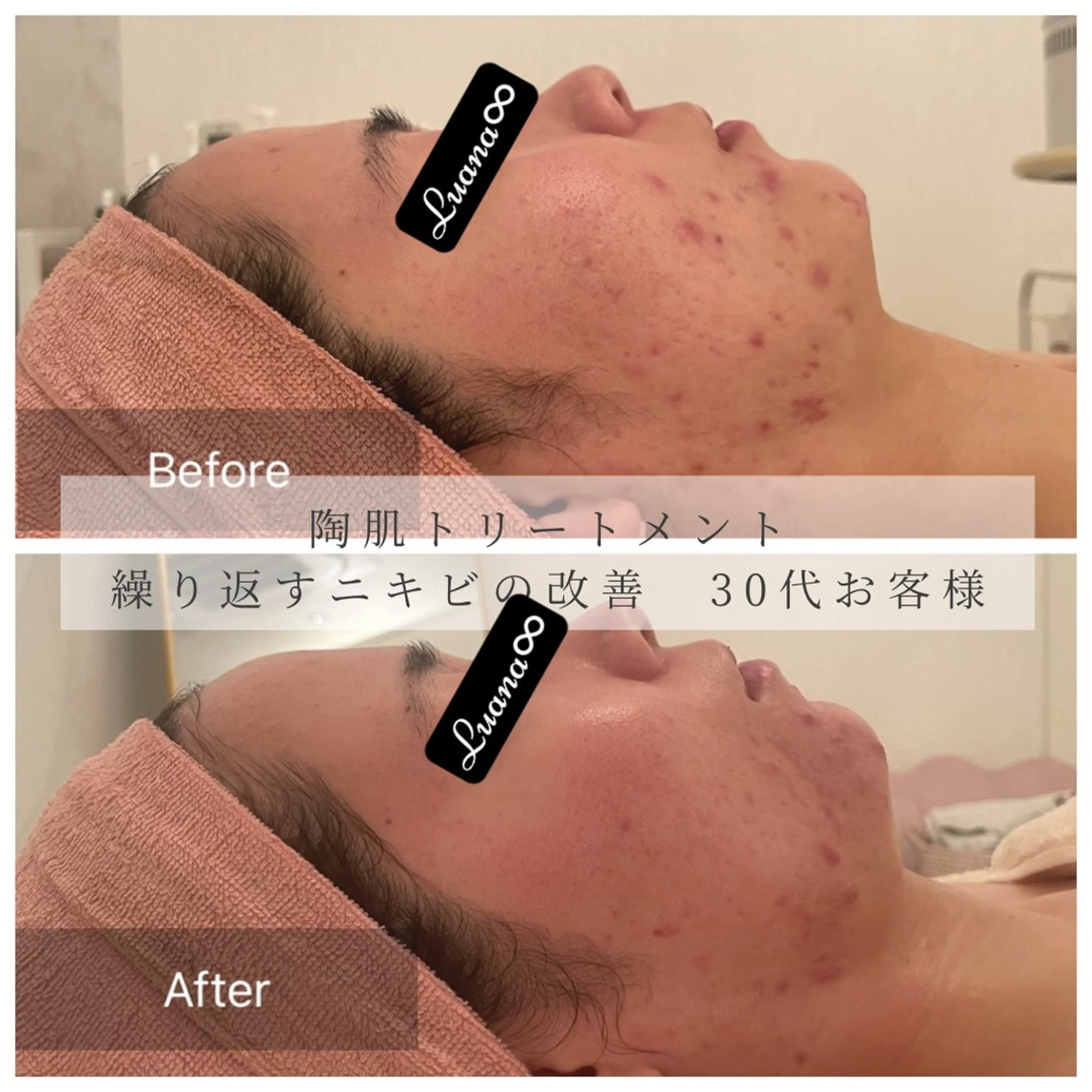 Luana ∞のエステ・リラクイメージ