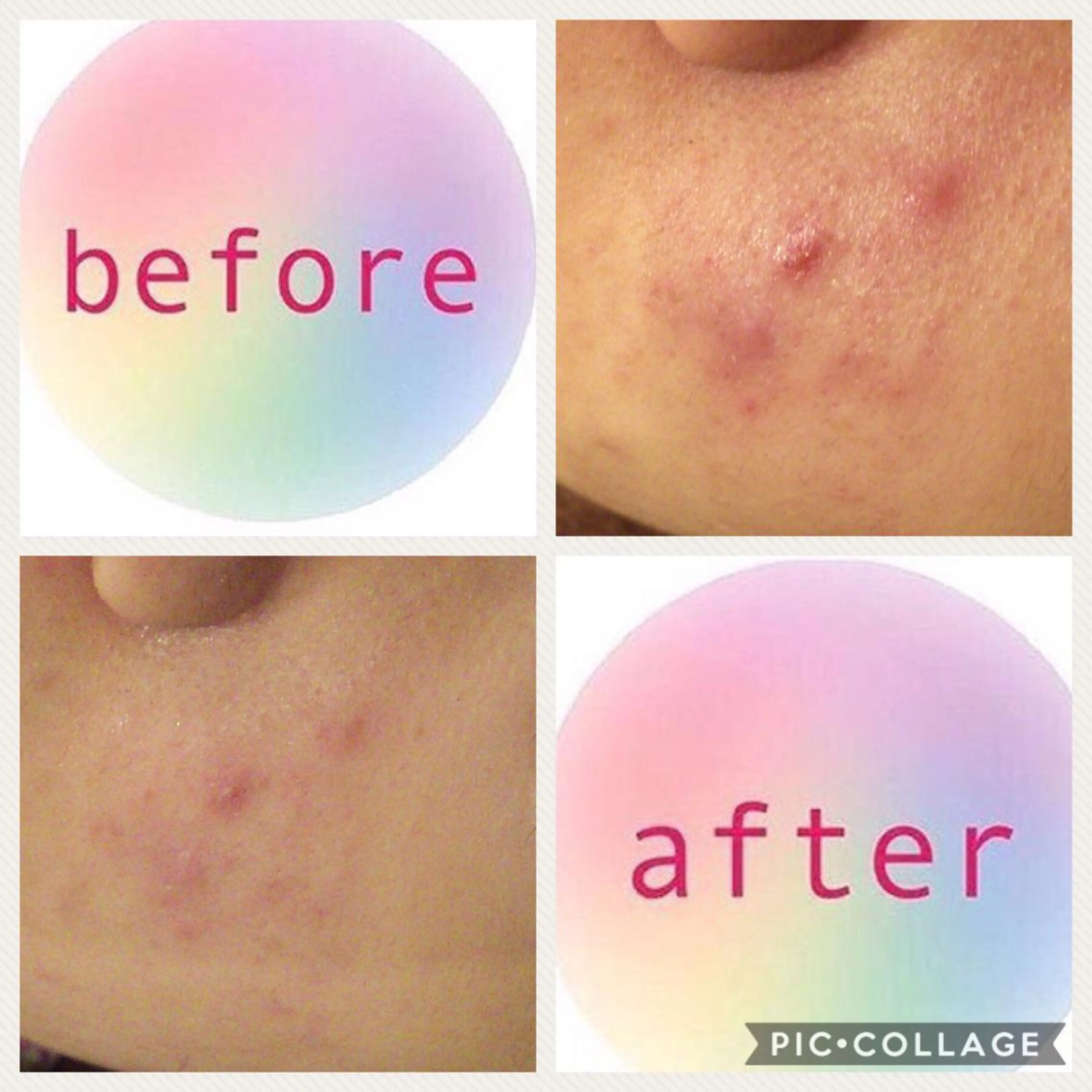 ミディアム カラー パーマ ヘアアレンジ メンズ キッズ ネイル マツエク・マツパ ニキビ・肌質改善専門 ♡人生が変わるサロンのエステ・リラクイメージ