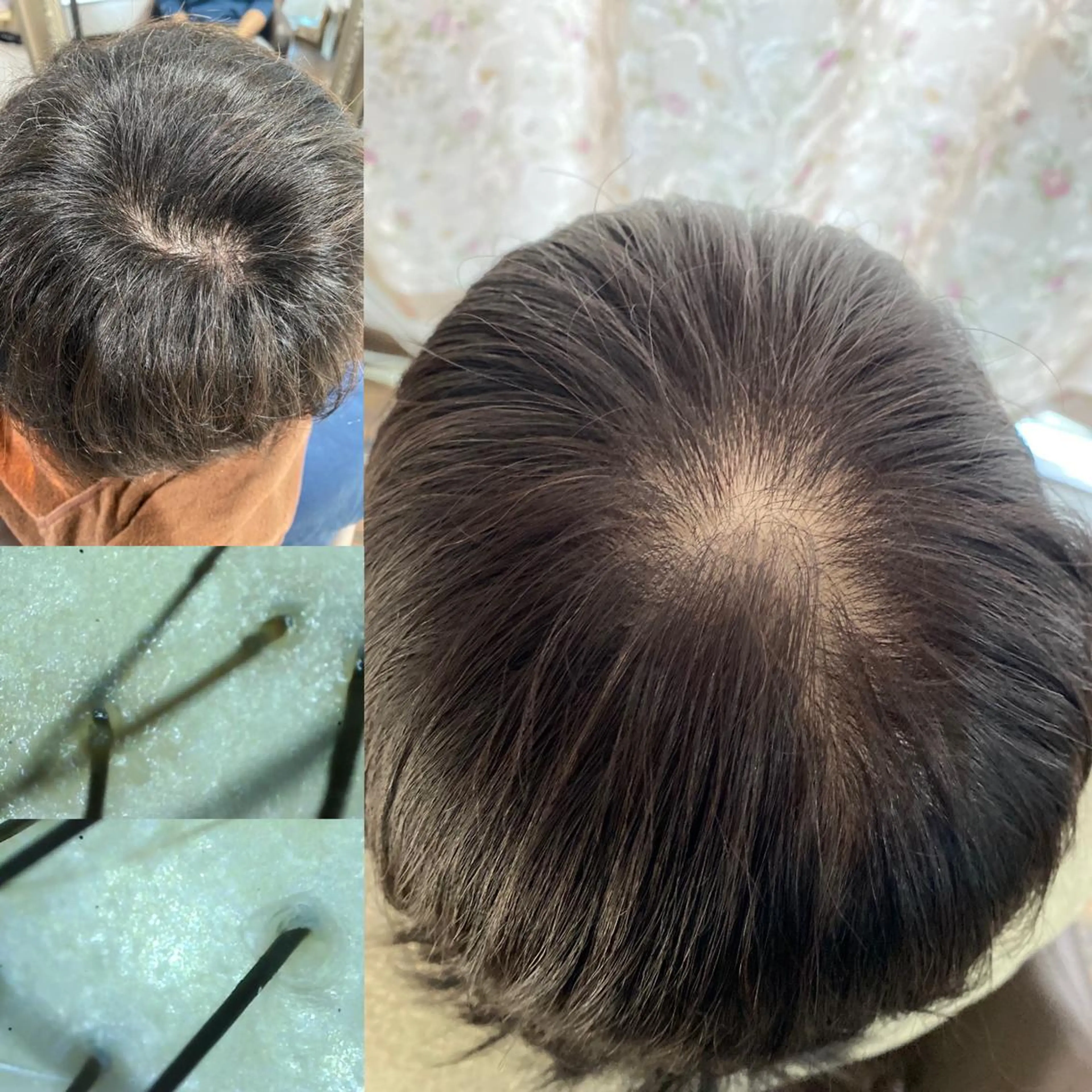 ゴトウ エイイチのヘアスタイル