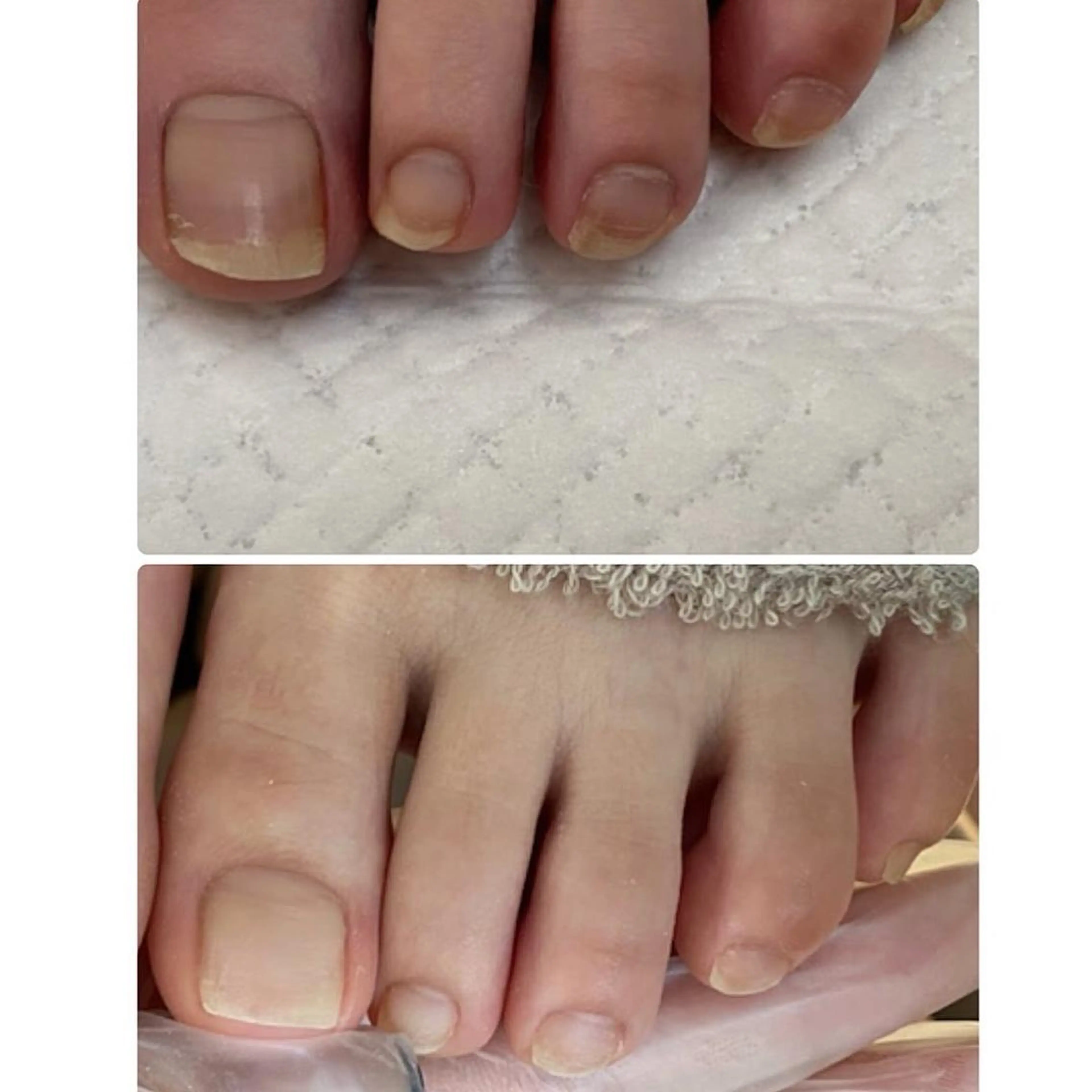 ネイル フットネイル その他(ネイル) and M. nailのネイルデザイン