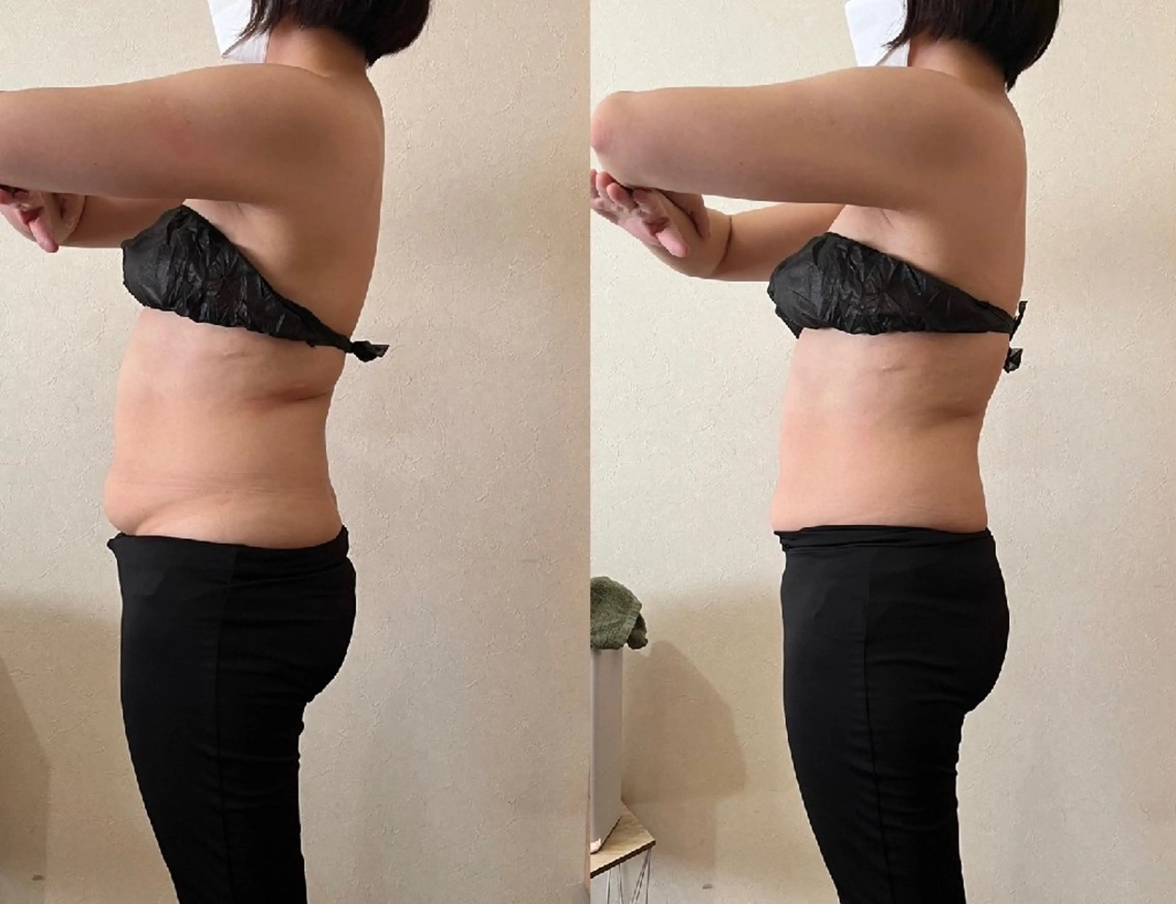 ｗキャビ、ｗ超音波、EMS特許取得マシーン【痩身/ダイエットしっかり3パーツ】痩せたいご希望の部位80分の写真