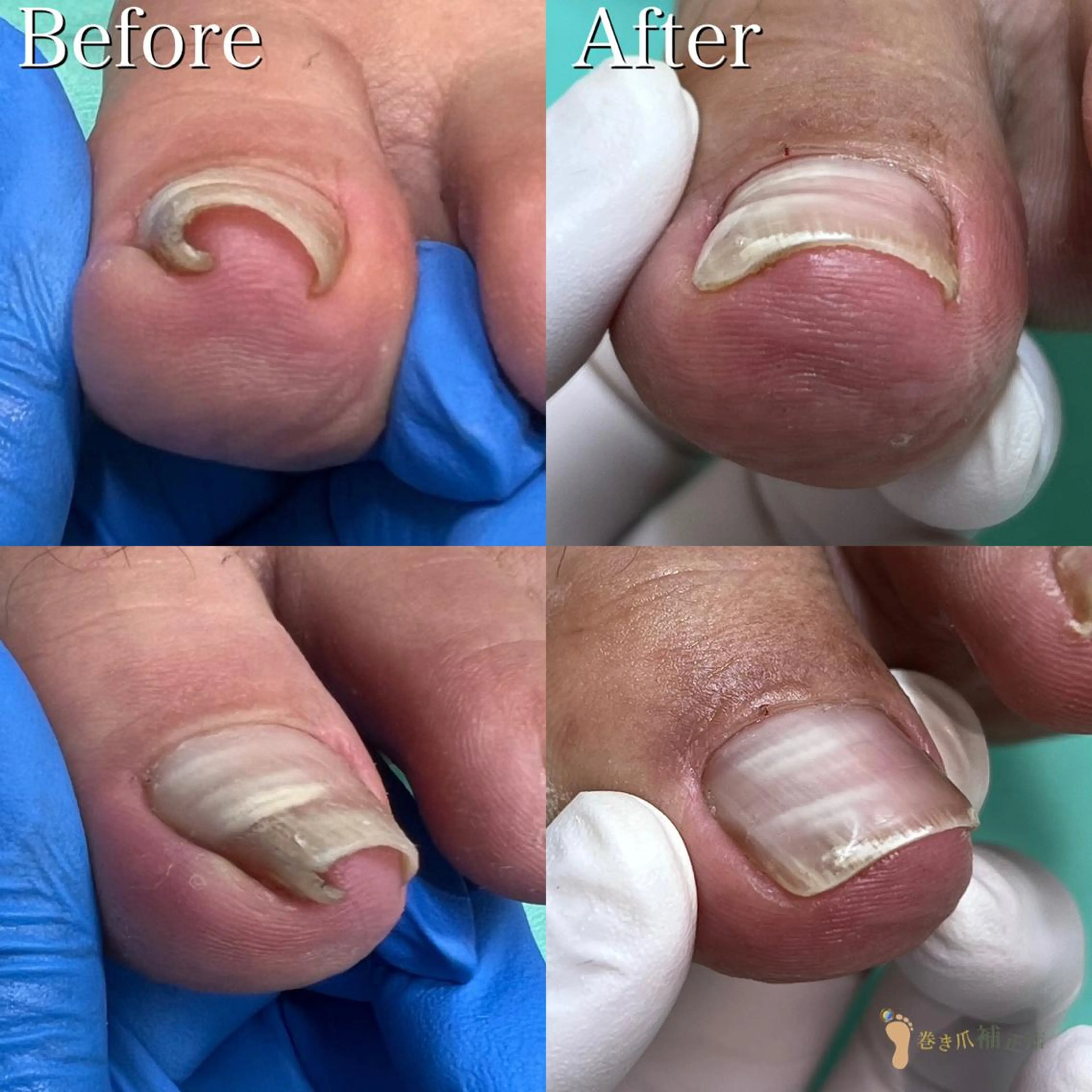 ネイル 東京巻き爪アカデミー所属・東京巻き爪 アカデミーのエステ・リラクイメージ