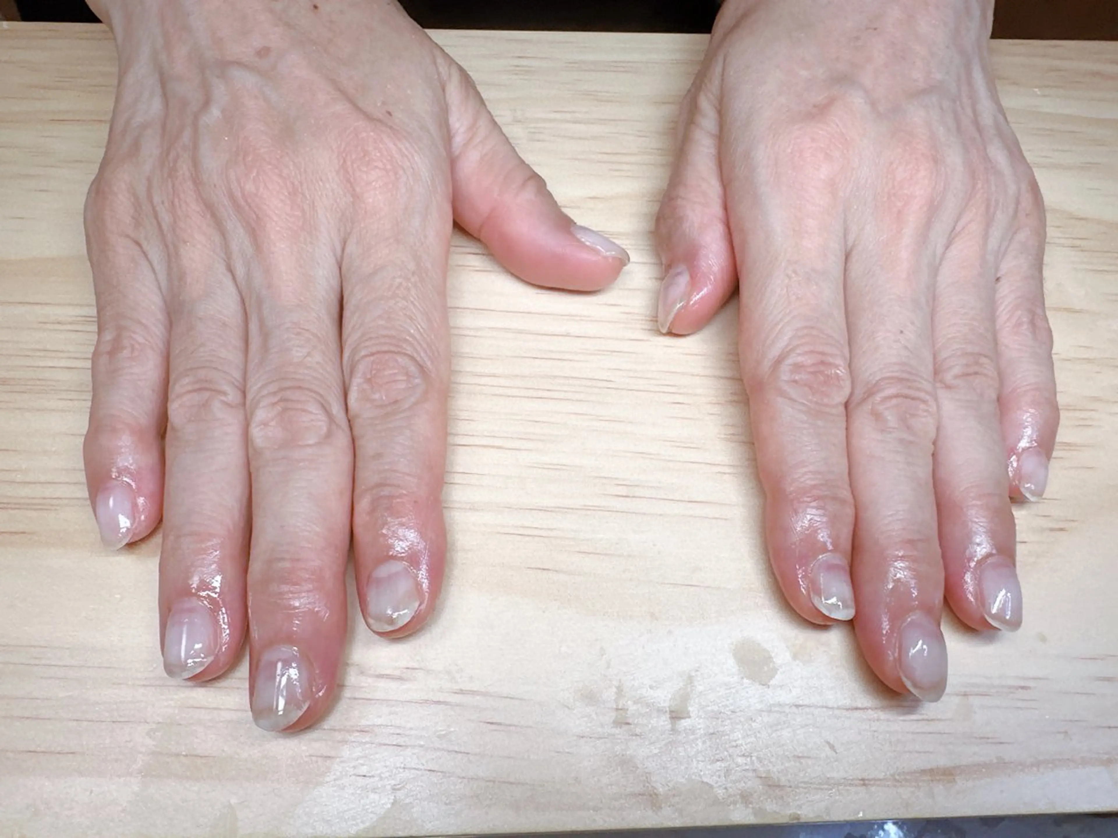 ネイル 高島 夏海のネイルデザイン