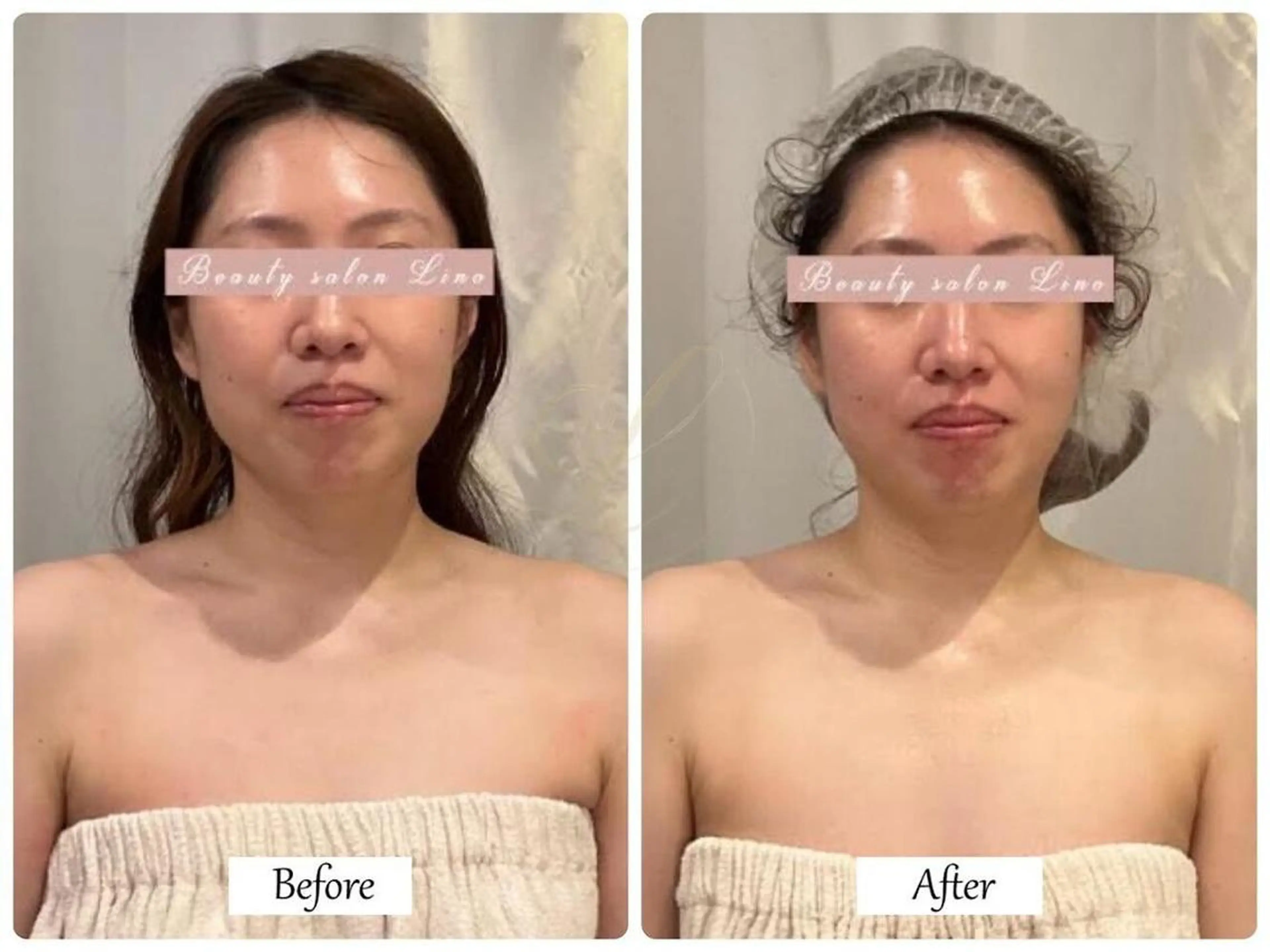 【顏】フェイスライン引上げ★別人級小顔サイズダウン◎リリースカッター50分の写真