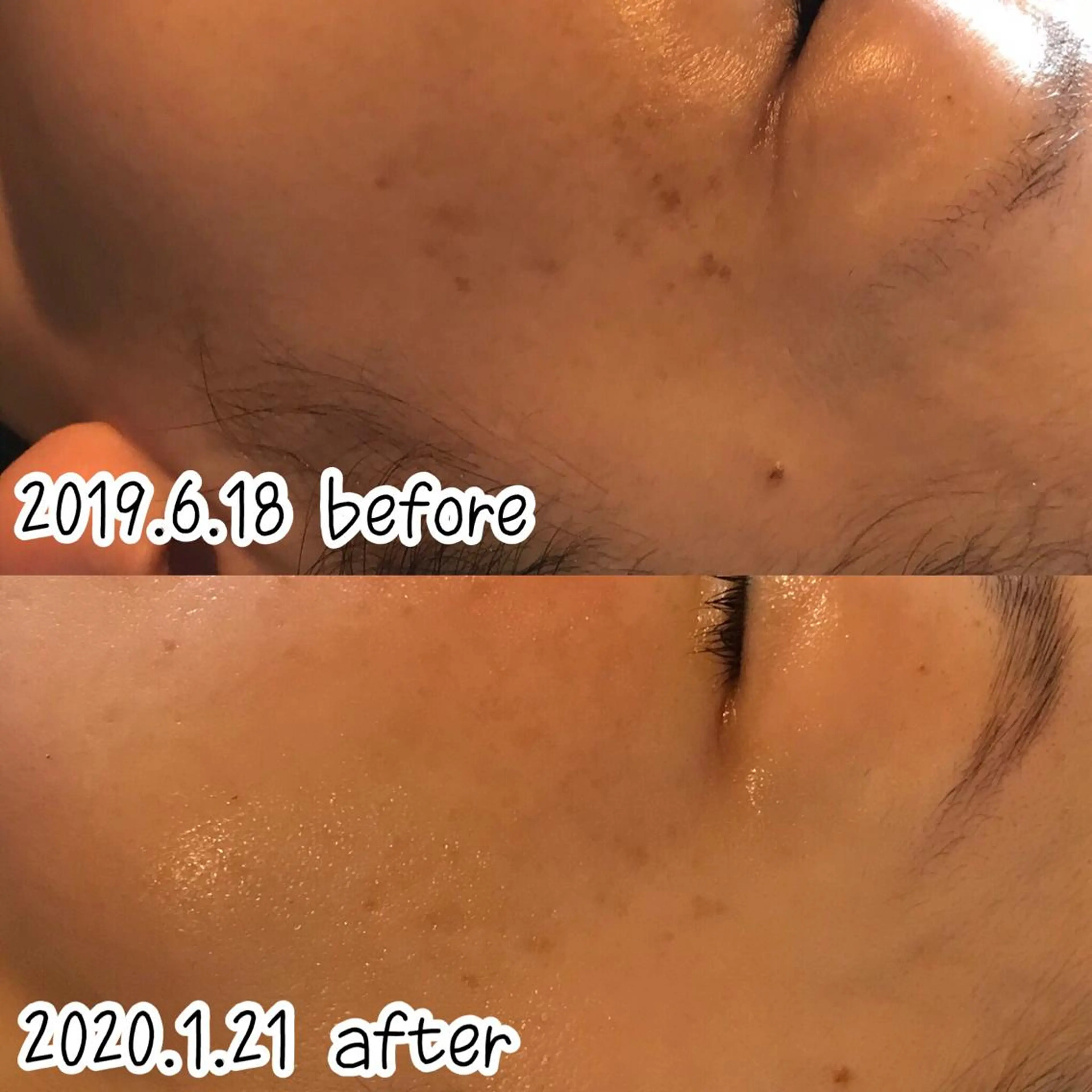 エステ 浜野 恵美のエステ・リラクイメージ