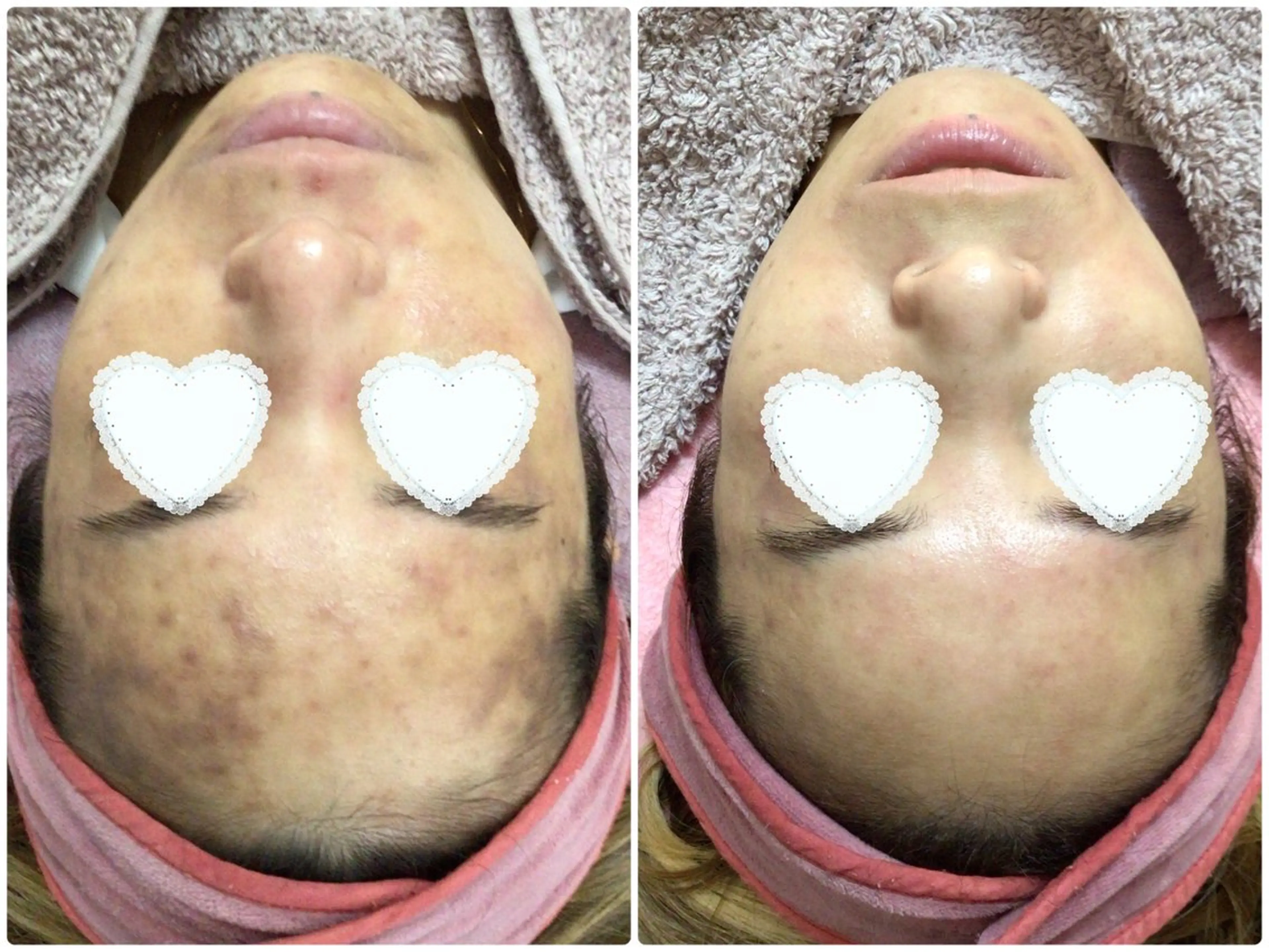 Knine所属・Knine 心斎橋店のエステ・リラクイメージ