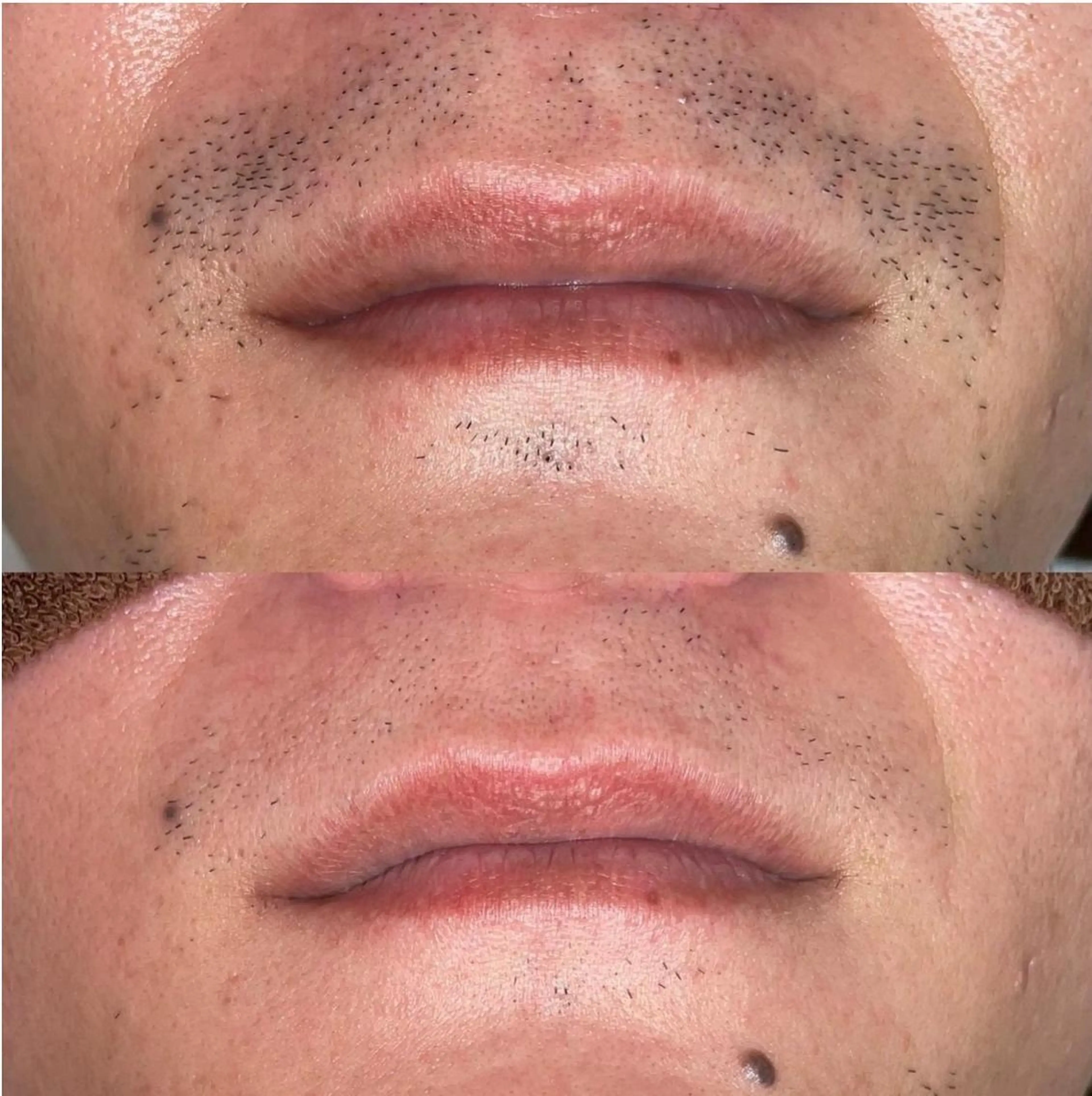 脱毛 藤元 絵梨子のエステ・リラクイメージ