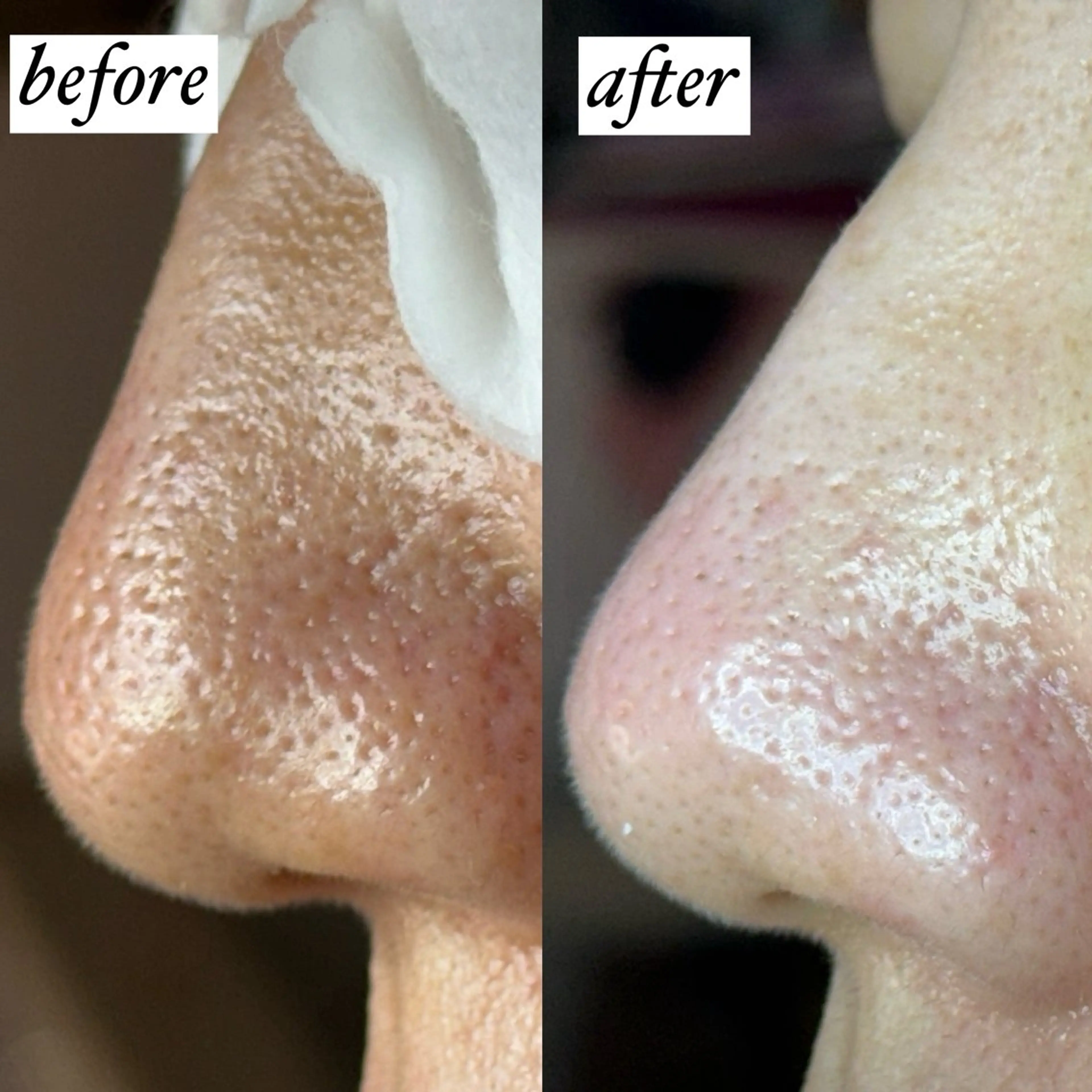 毛穴専門サロン ライカブルーのエステ・リラクイメージ