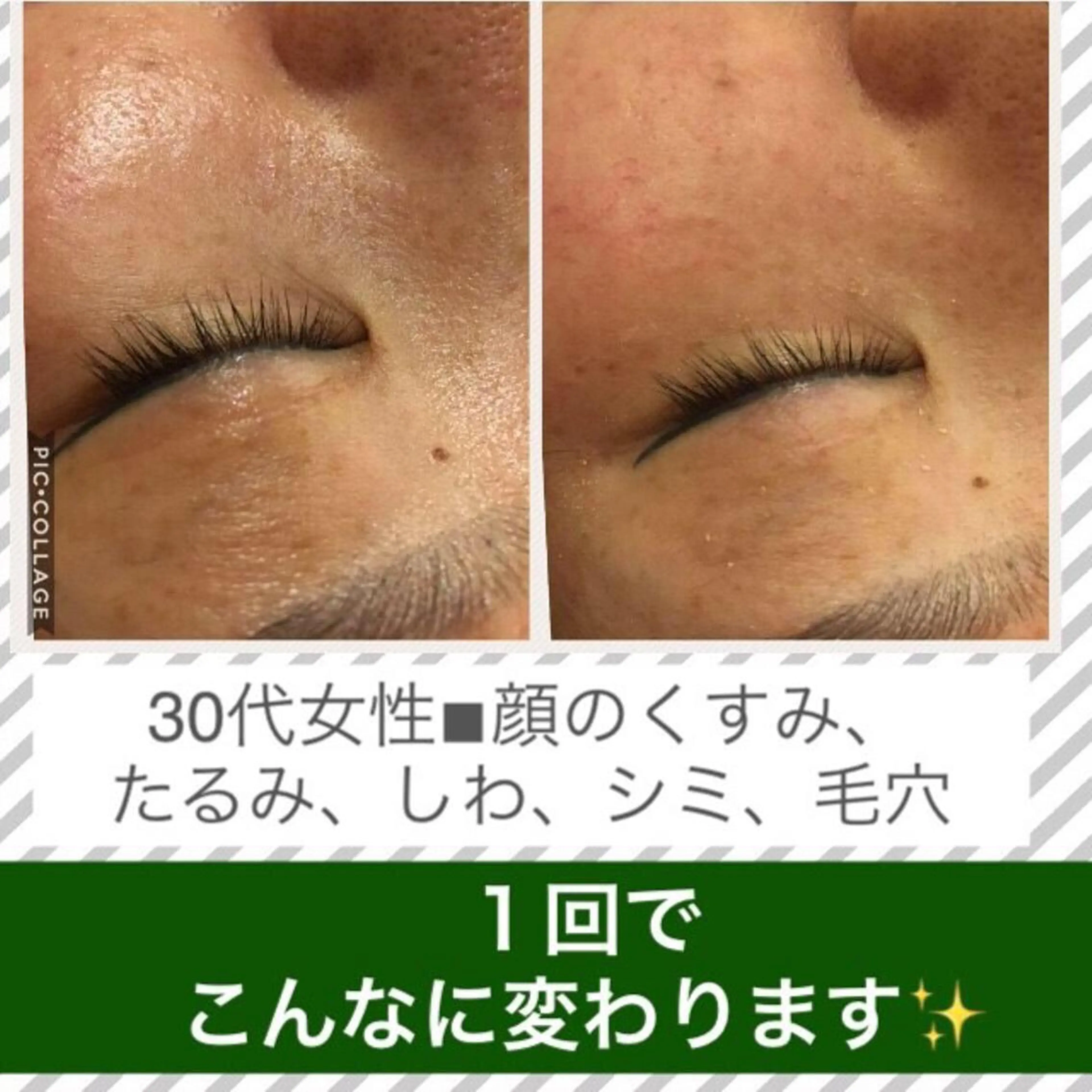 ミディアム カラー パーマ ヘアアレンジ メンズ キッズ ネイル マツエク・マツパ ニキビ・肌質改善専門 ♡人生が変わるサロンのエステ・リラクイメージ