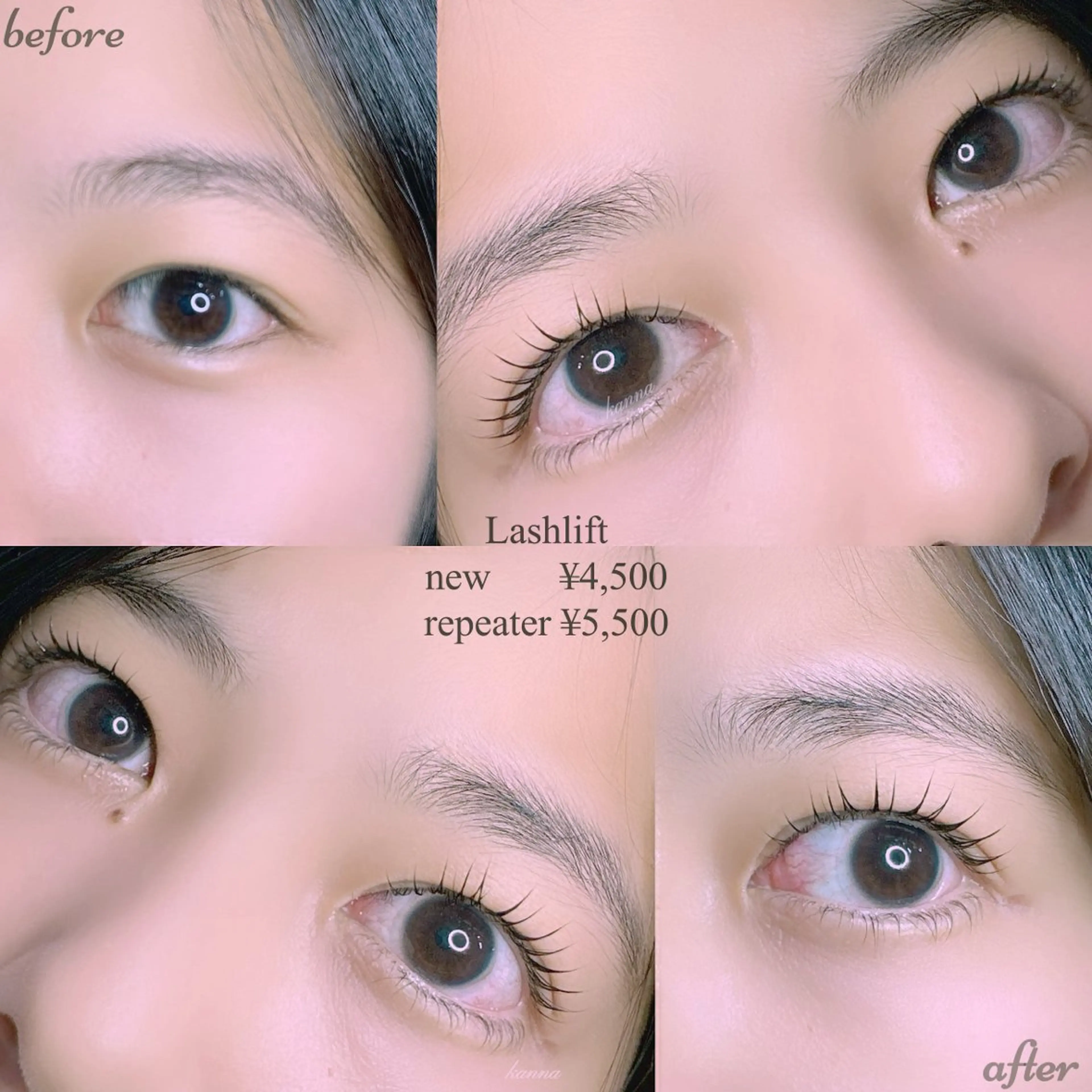 マツエク・マツパ Abientot Kannaのマツエク・マツパデザイン