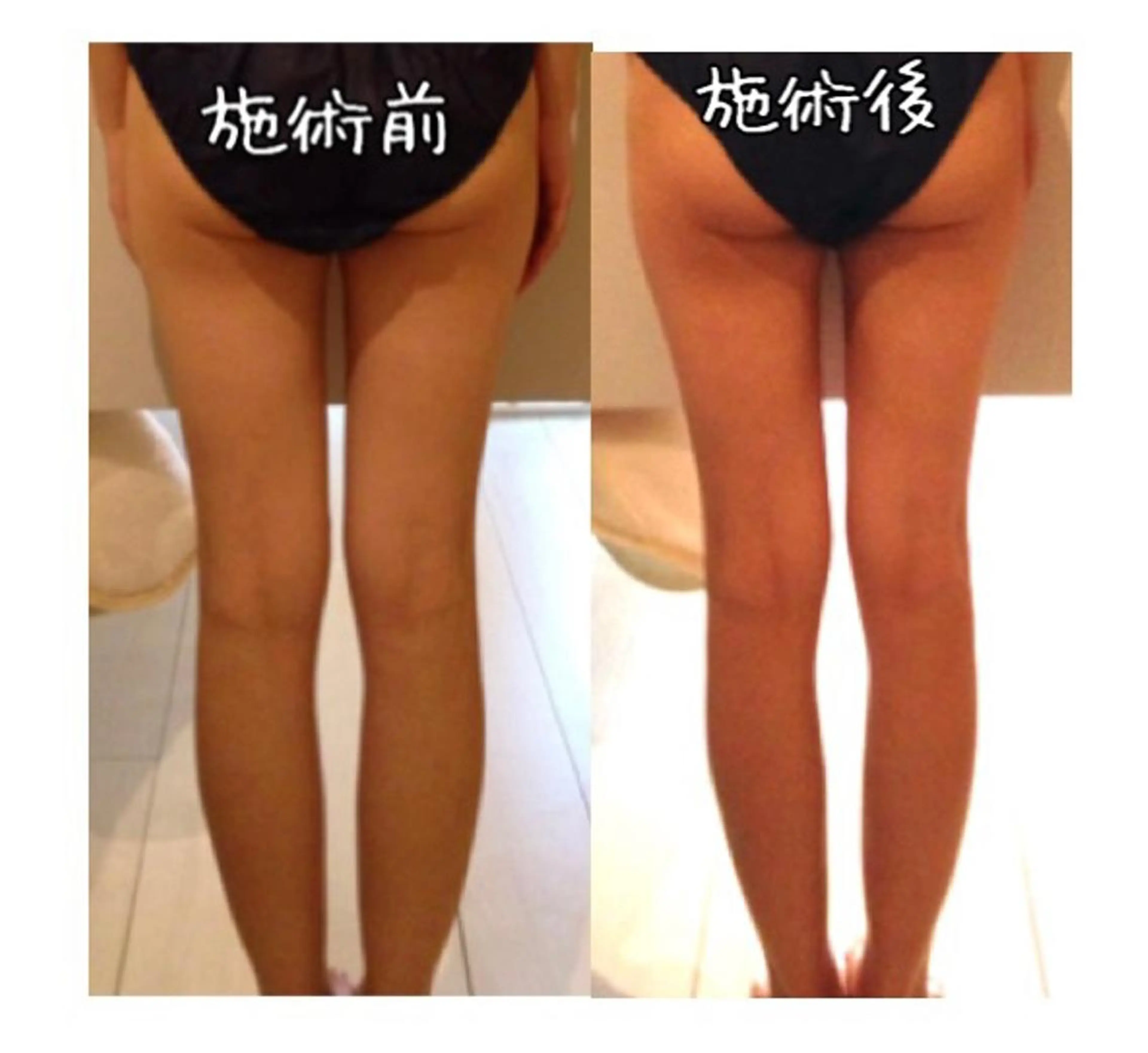 ミディアム カラー パーマ ヘアアレンジ メンズ キッズ ネイル マツエク・マツパ 強圧オールハンド痩身&黄土よもぎ蒸しプライベートサロンClematis池袋所属・強圧オールハンド痩身 片野のエステ・リラクイメージ