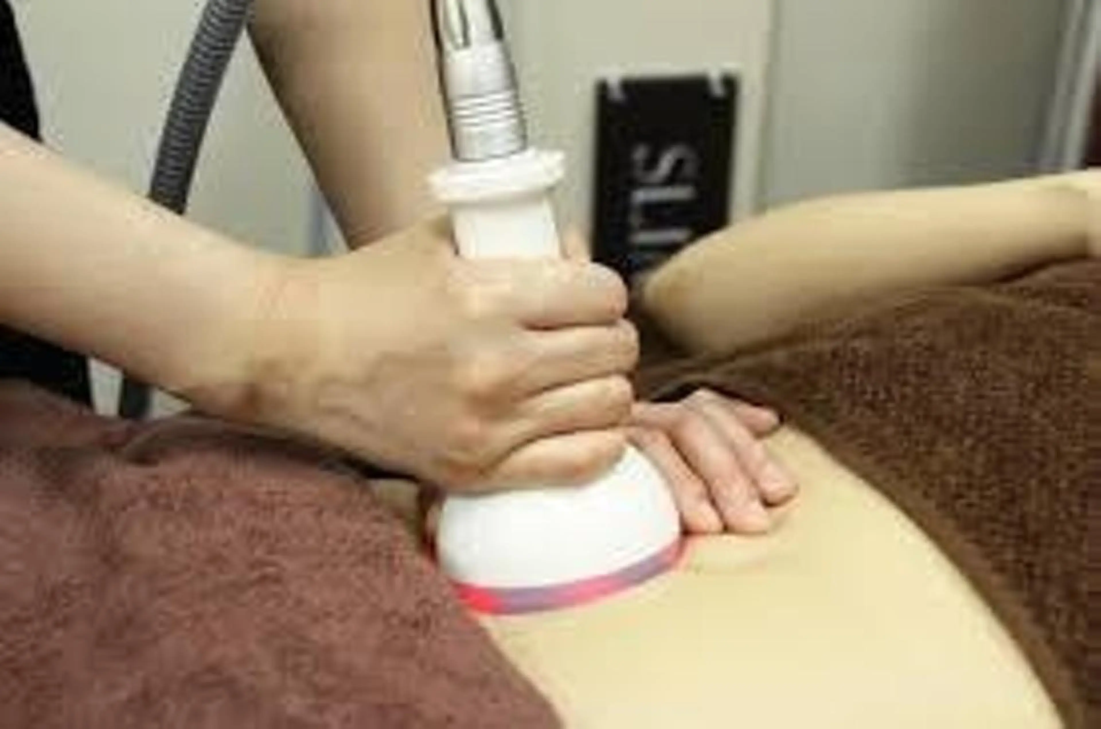 燃やせ！セル脂肪撃破！スリムムーヴ痩身　半身60分コース　通常￥13,200→¥3300の写真