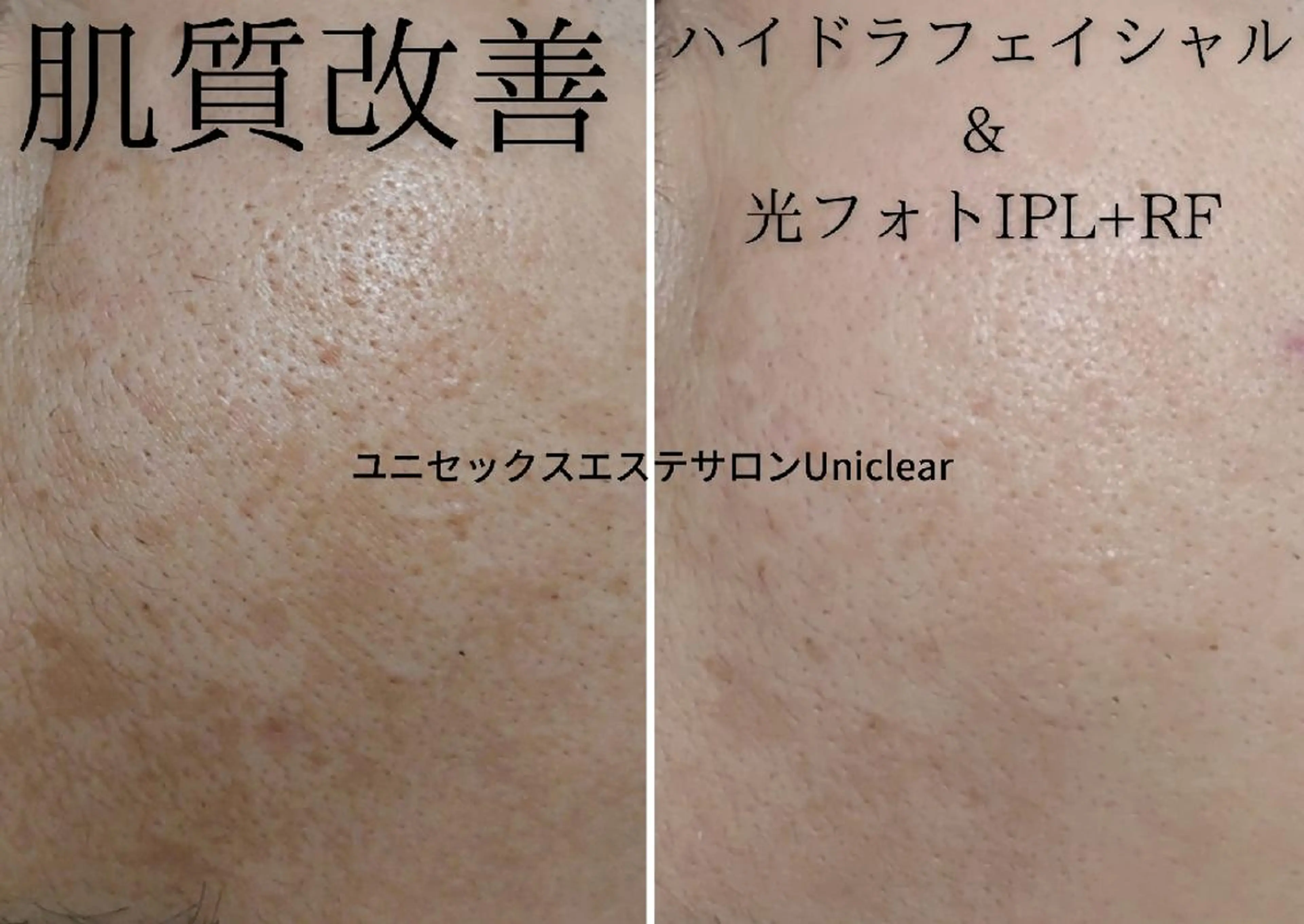 ユニセックスエステサロンUniclear所属・痩身&フェイシャル Uniclearのエステ・リラクイメージ