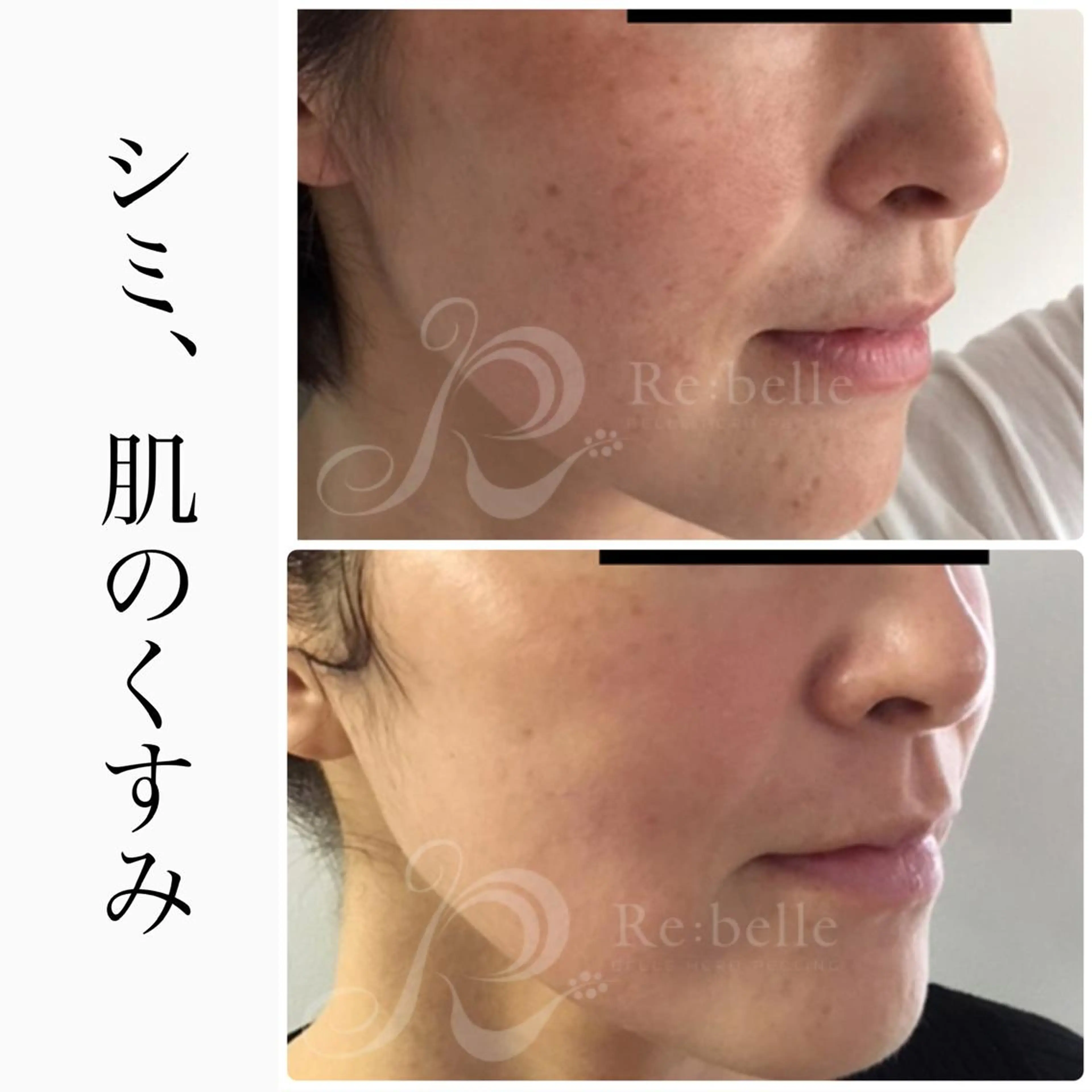 エステ ハーブピーリング専門 BIOEL横浜のエステ・リラクイメージ