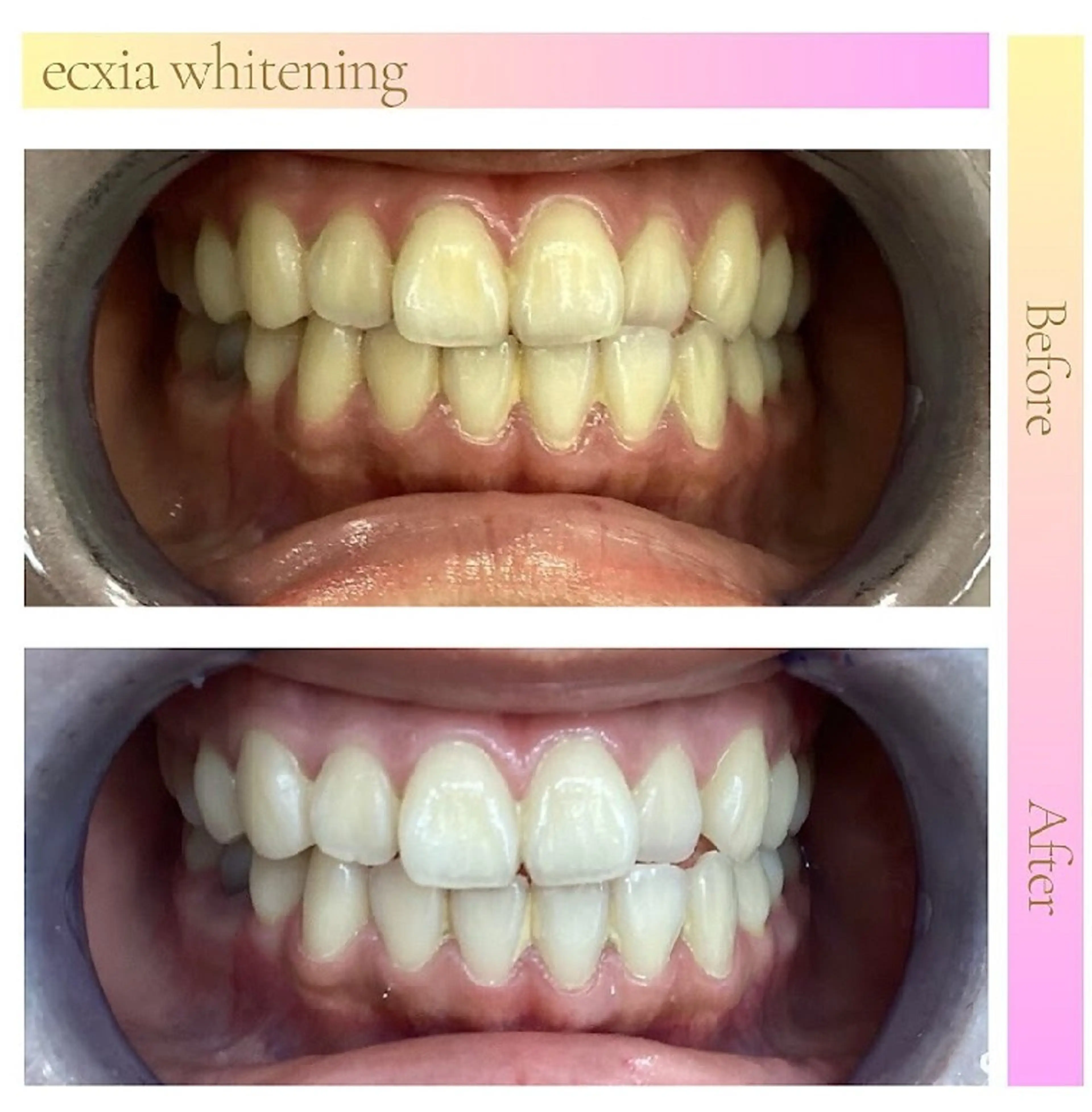 その他 エクシアホワイトニング草津店所属・nanami -ホワイトニングのその他イメージ