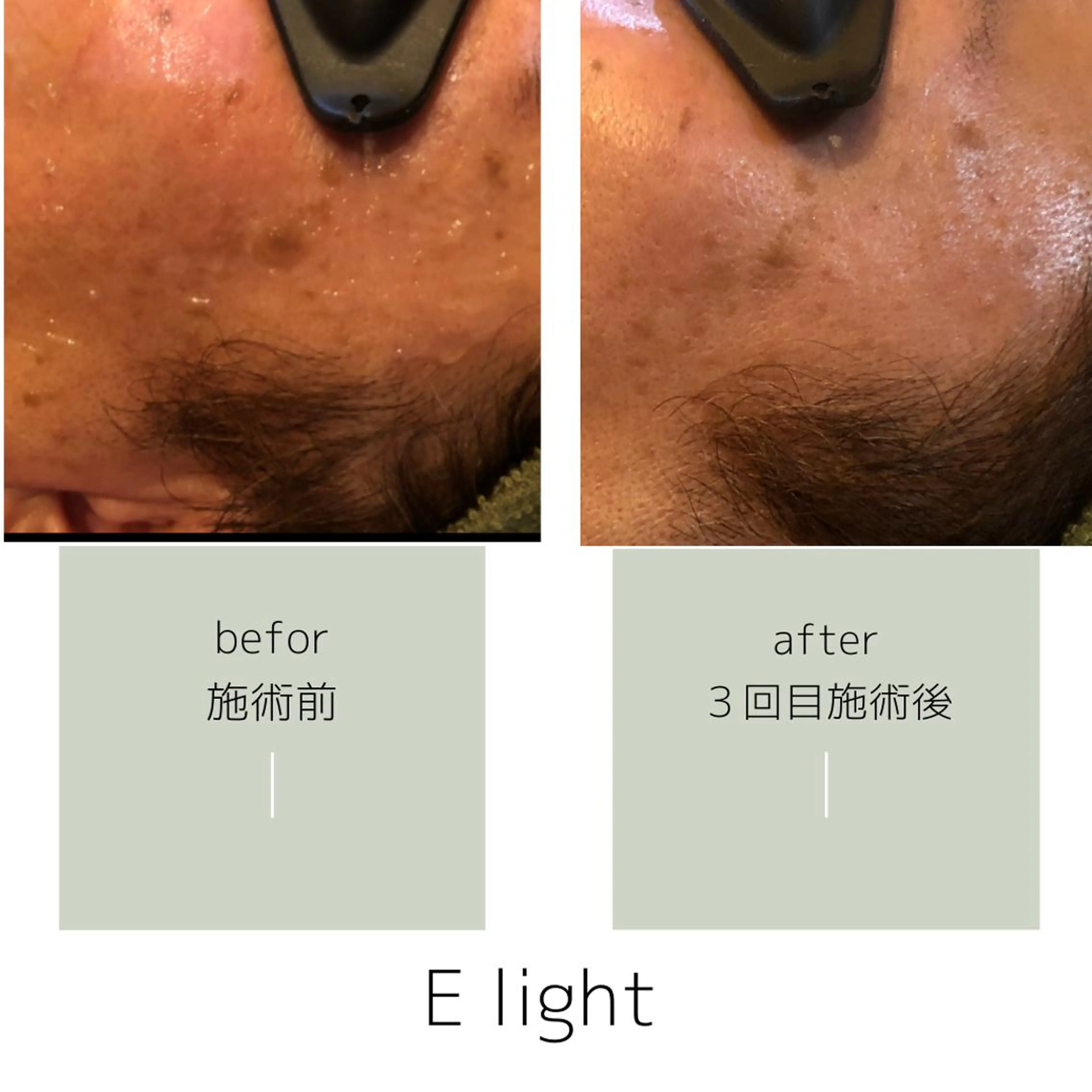 salon mijoaのエステ・リラクイメージ