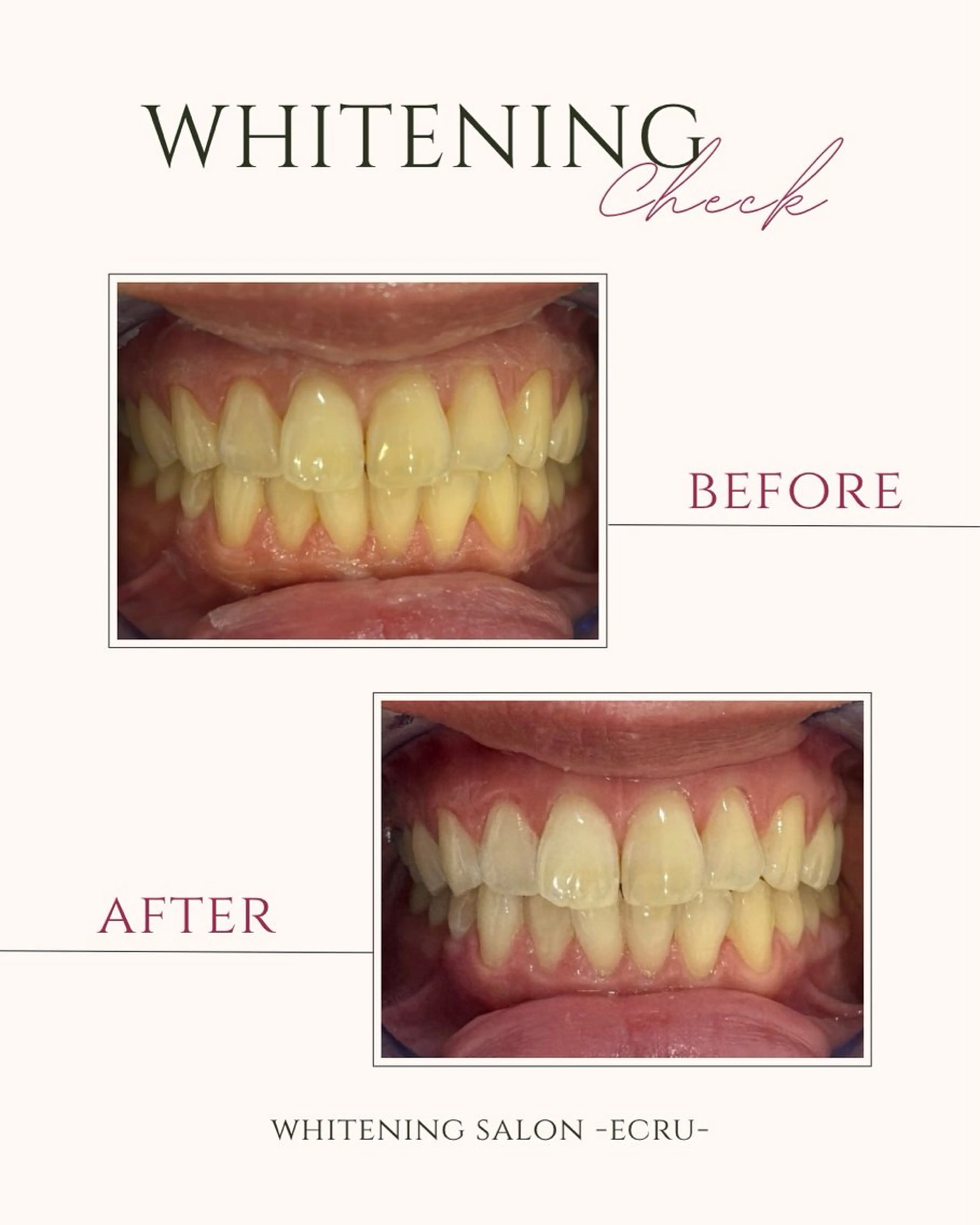 エステ ホワイトニングサロン Ecru所属・ホワイトニングサロン Ecru エクリュのその他イメージ