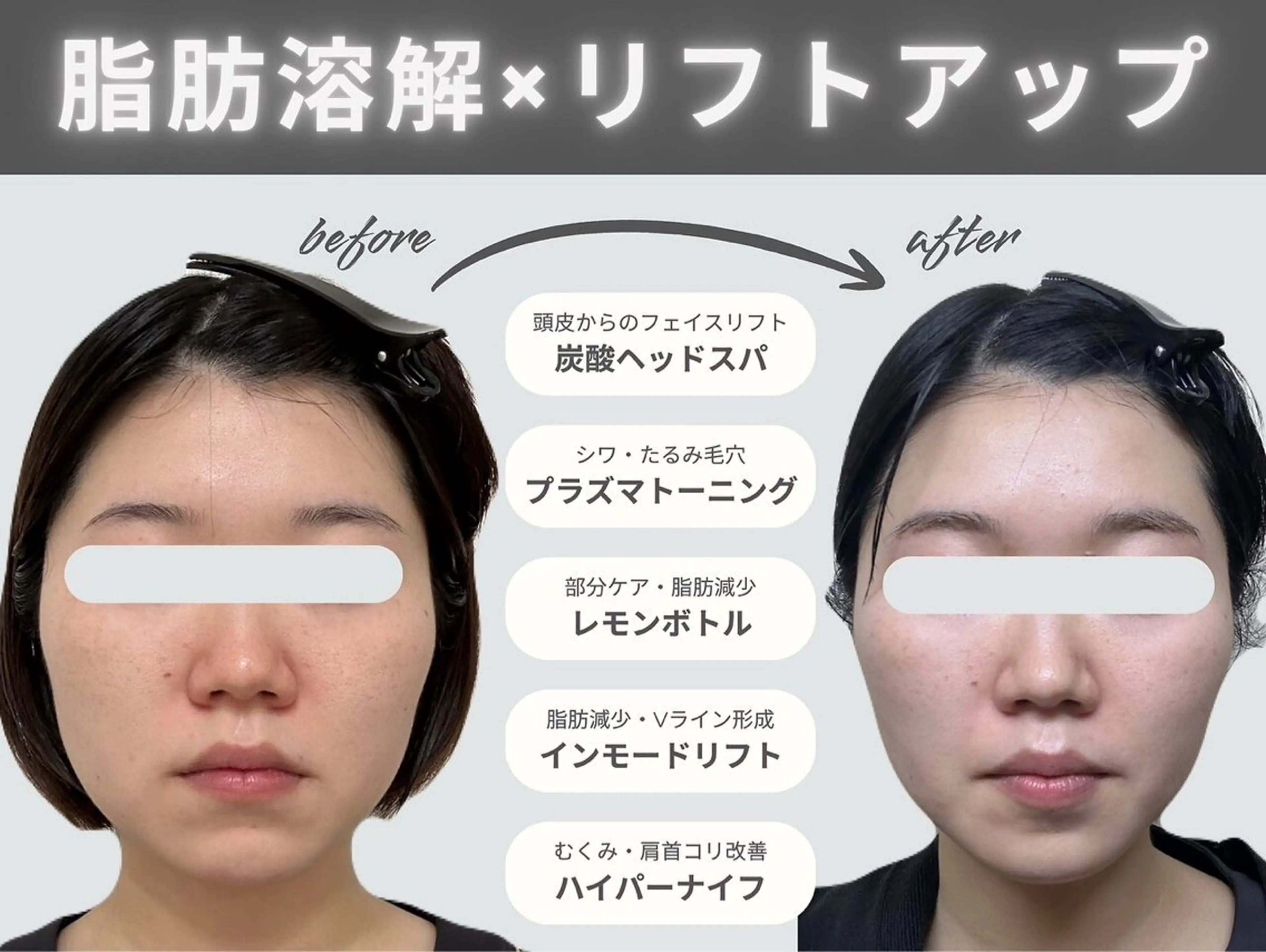 aimer 栄店のエステ・リラクイメージ