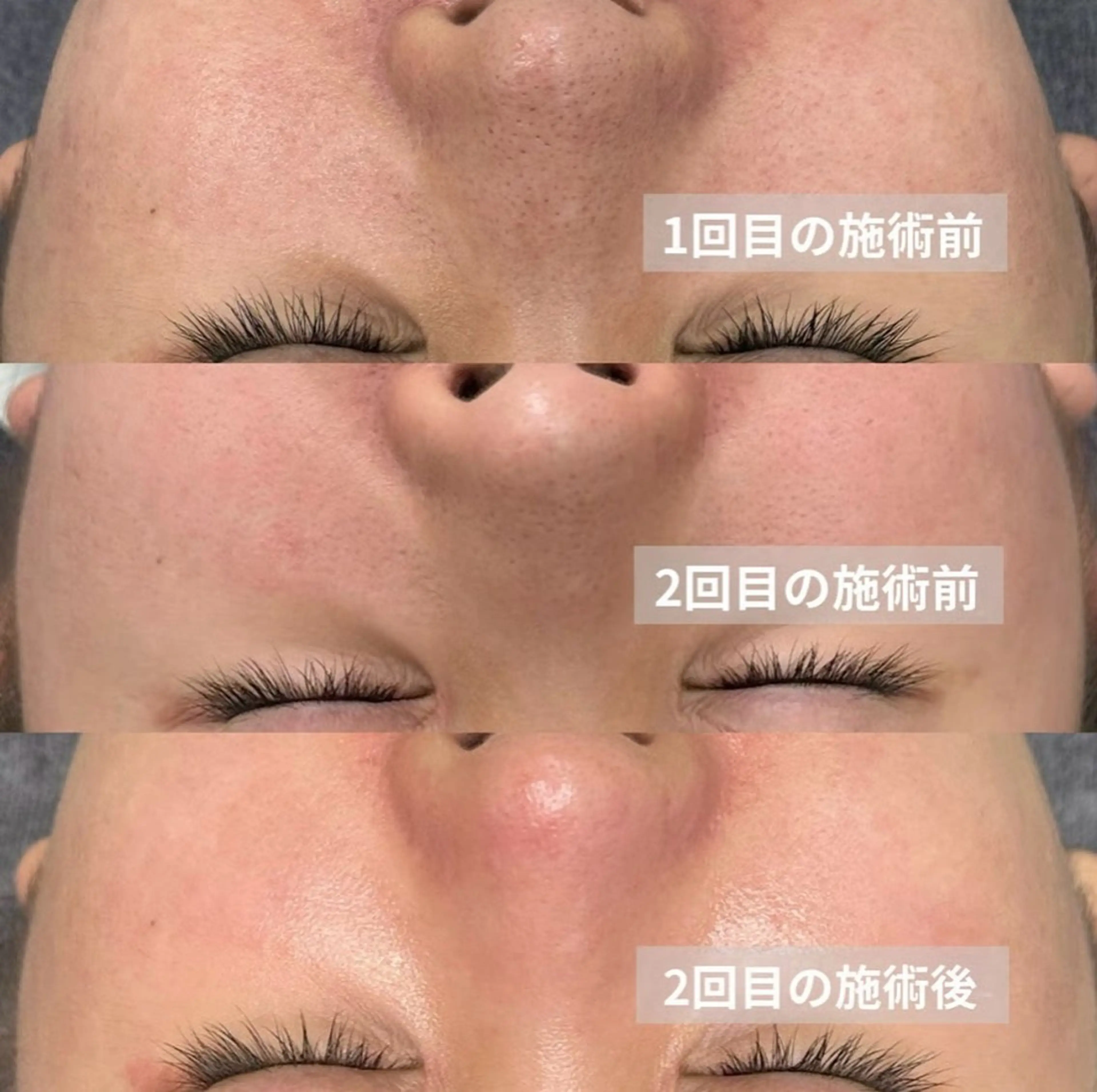 肌改善 une所属・肌改善 uneのエステ・リラクイメージ