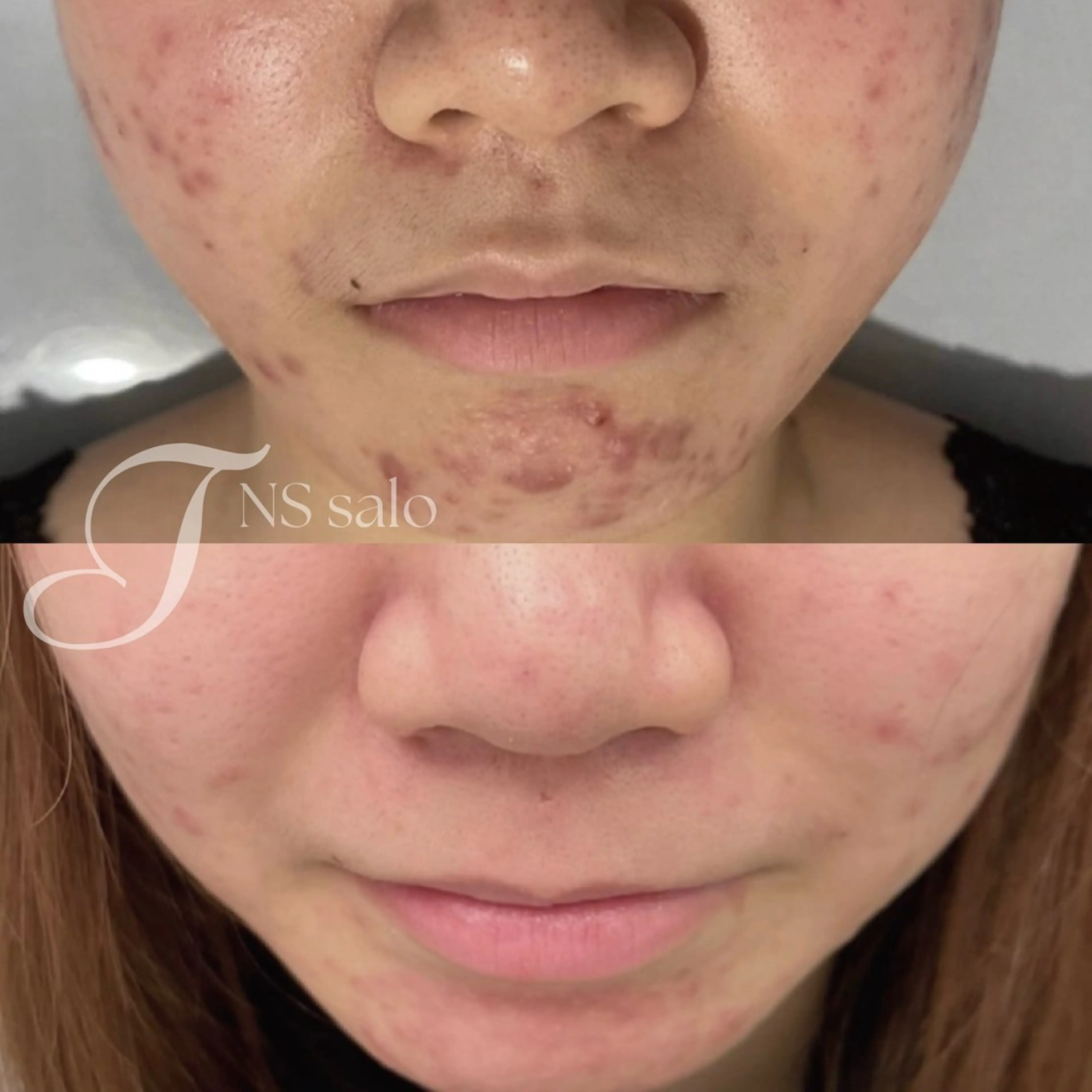 ナスサロ所属・💖韓国肌管理 :美容看護師/T🪽のエステ・リラクイメージ