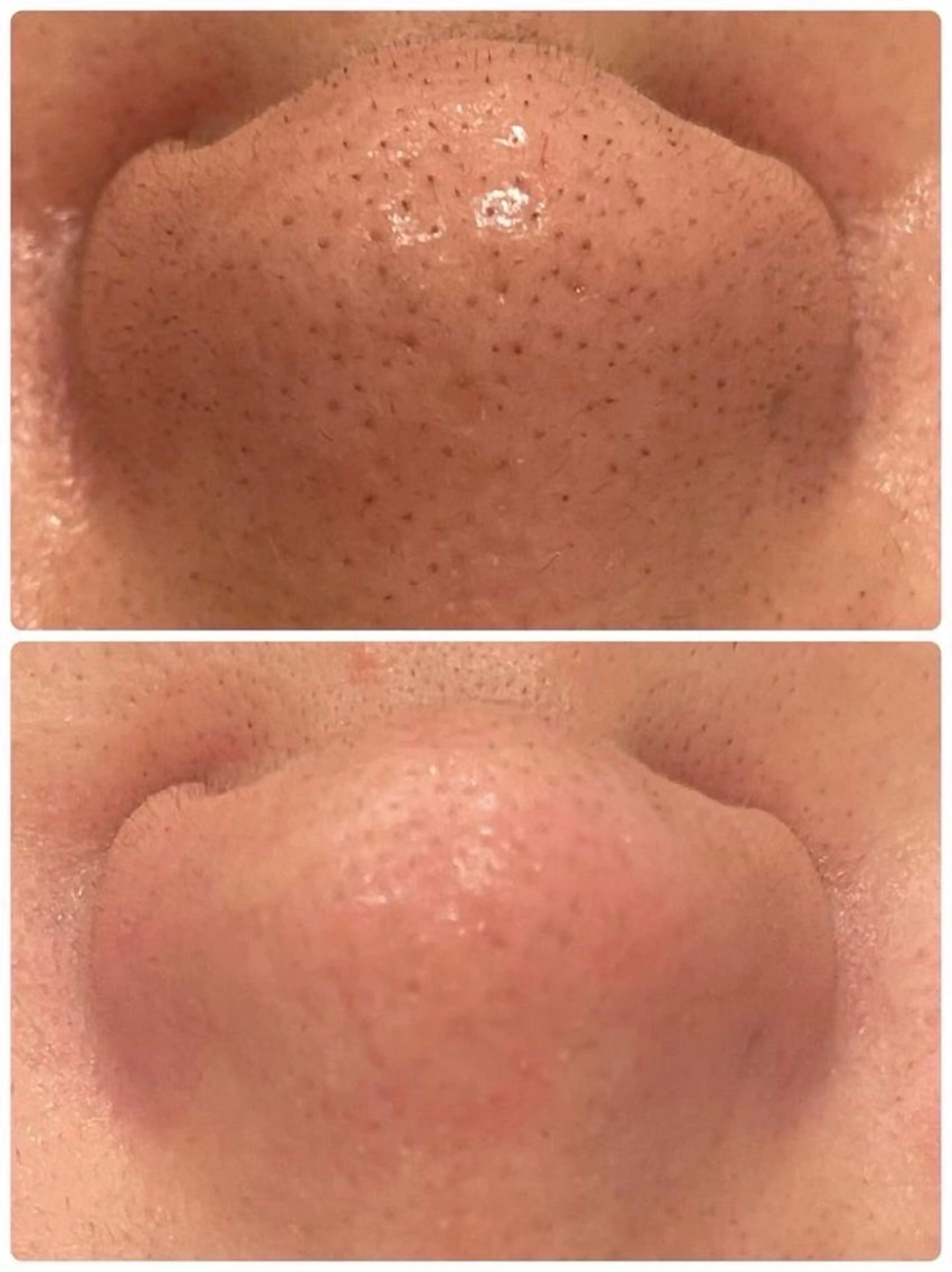 メンズ 美Face所属・美 Faceのエステ・リラクイメージ