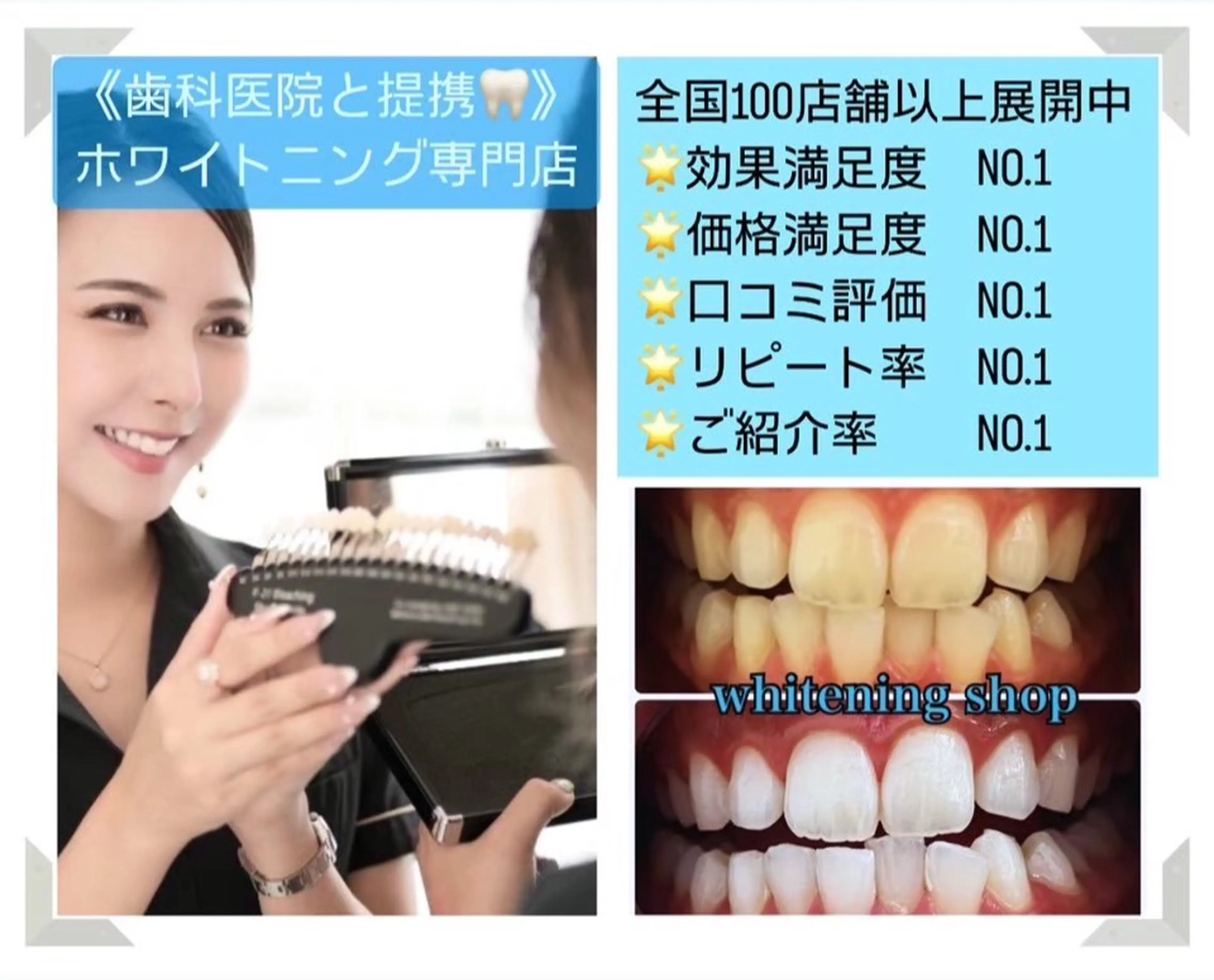 ホワイトニングショップ伊丹店所属・ホワイトニング ショップ伊丹店のその他イメージ