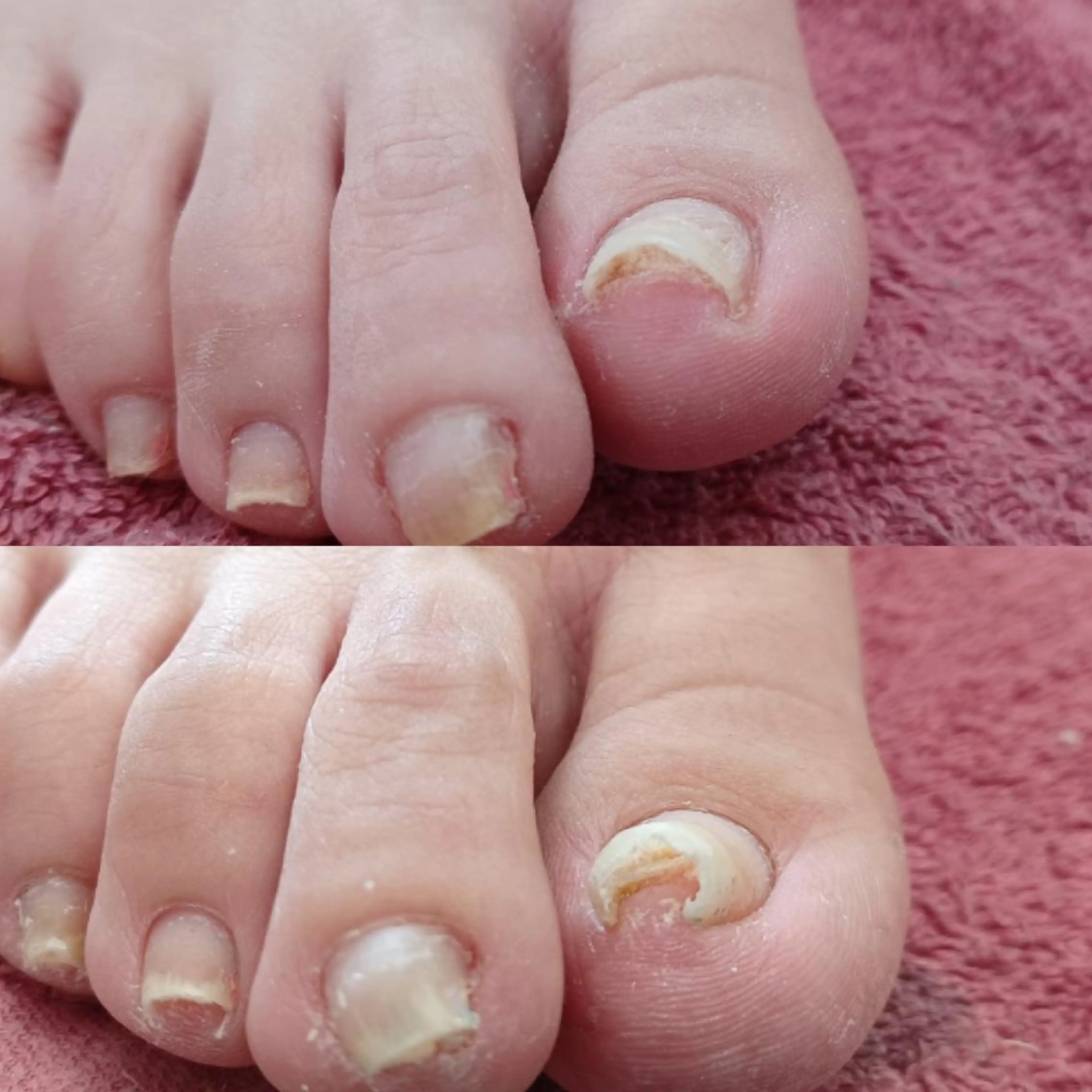 ネイル Micky nail chikushinoのネイルデザイン