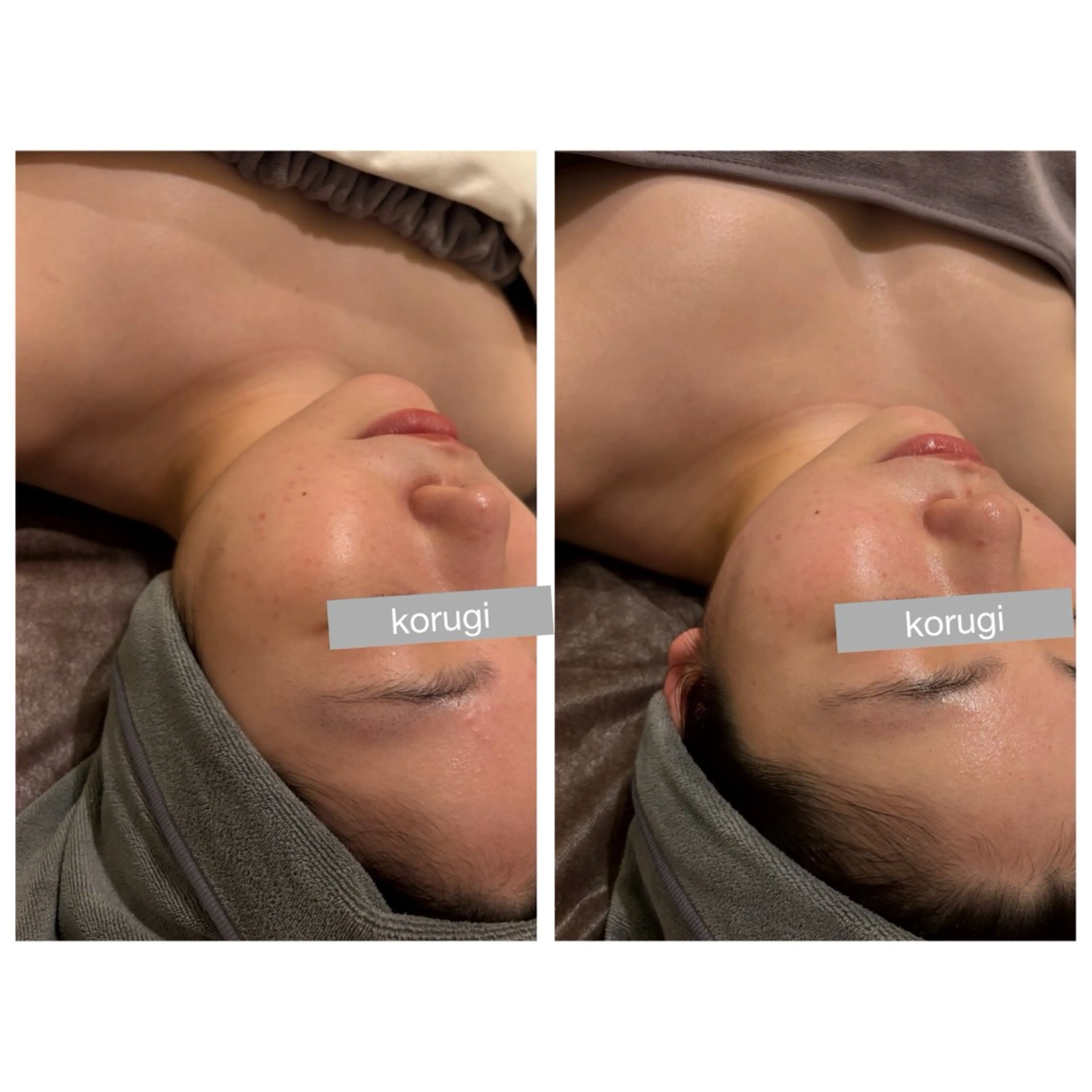 ☆痩身/小顔☆ コルギのエステ・リラクイメージ