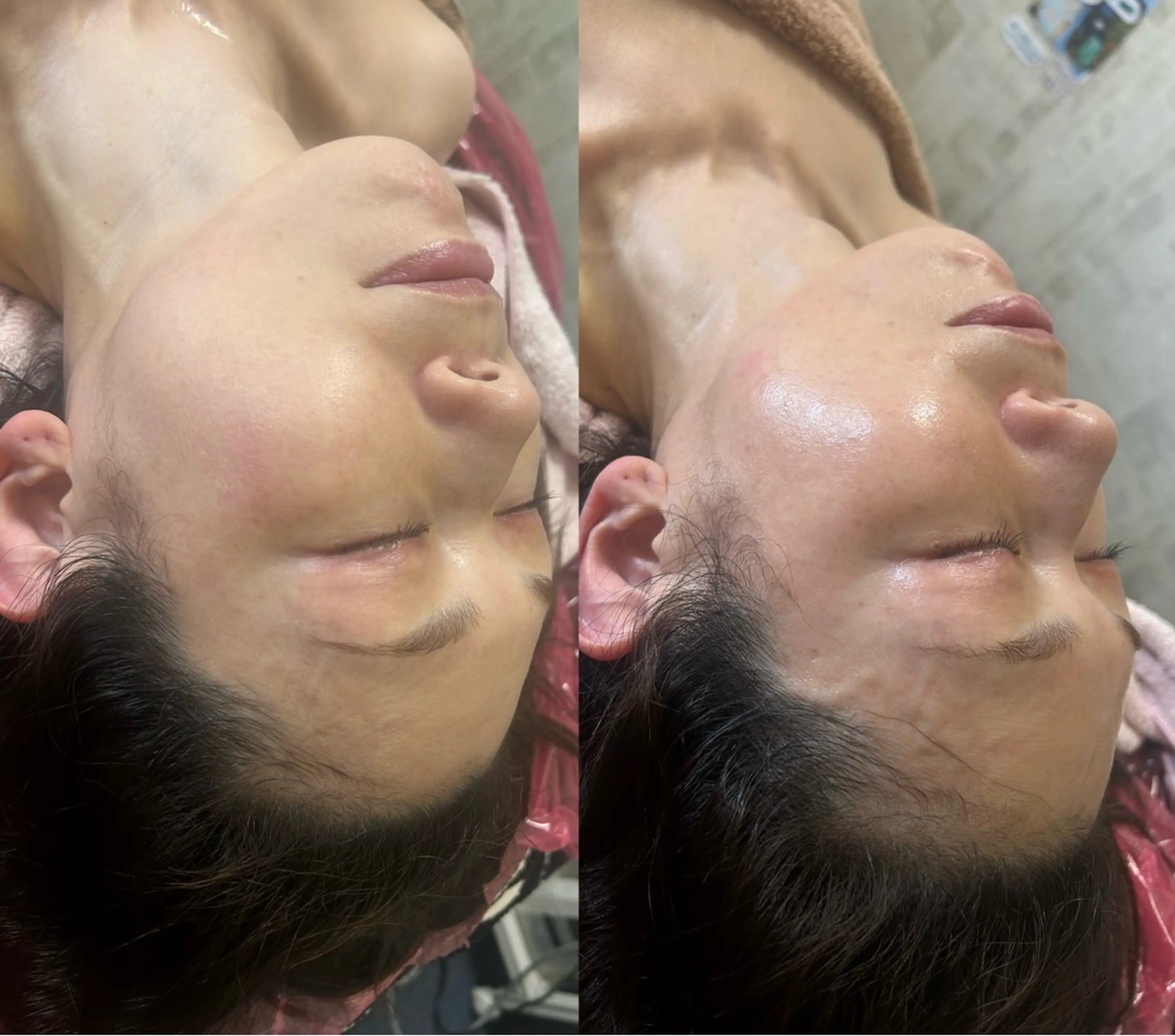 美容鍼灸サロン mahoroba院長のエステ・リラクイメージ