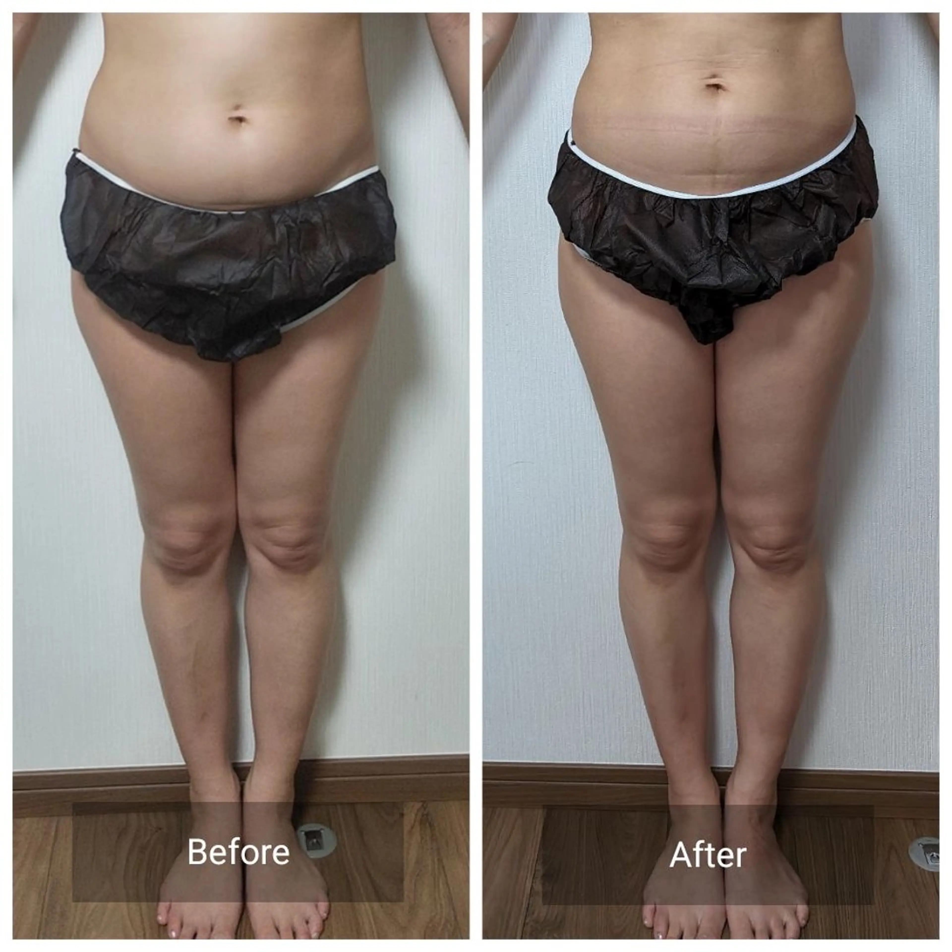 エステ nail RiRi アトレナチュラのエステ・リラクイメージ