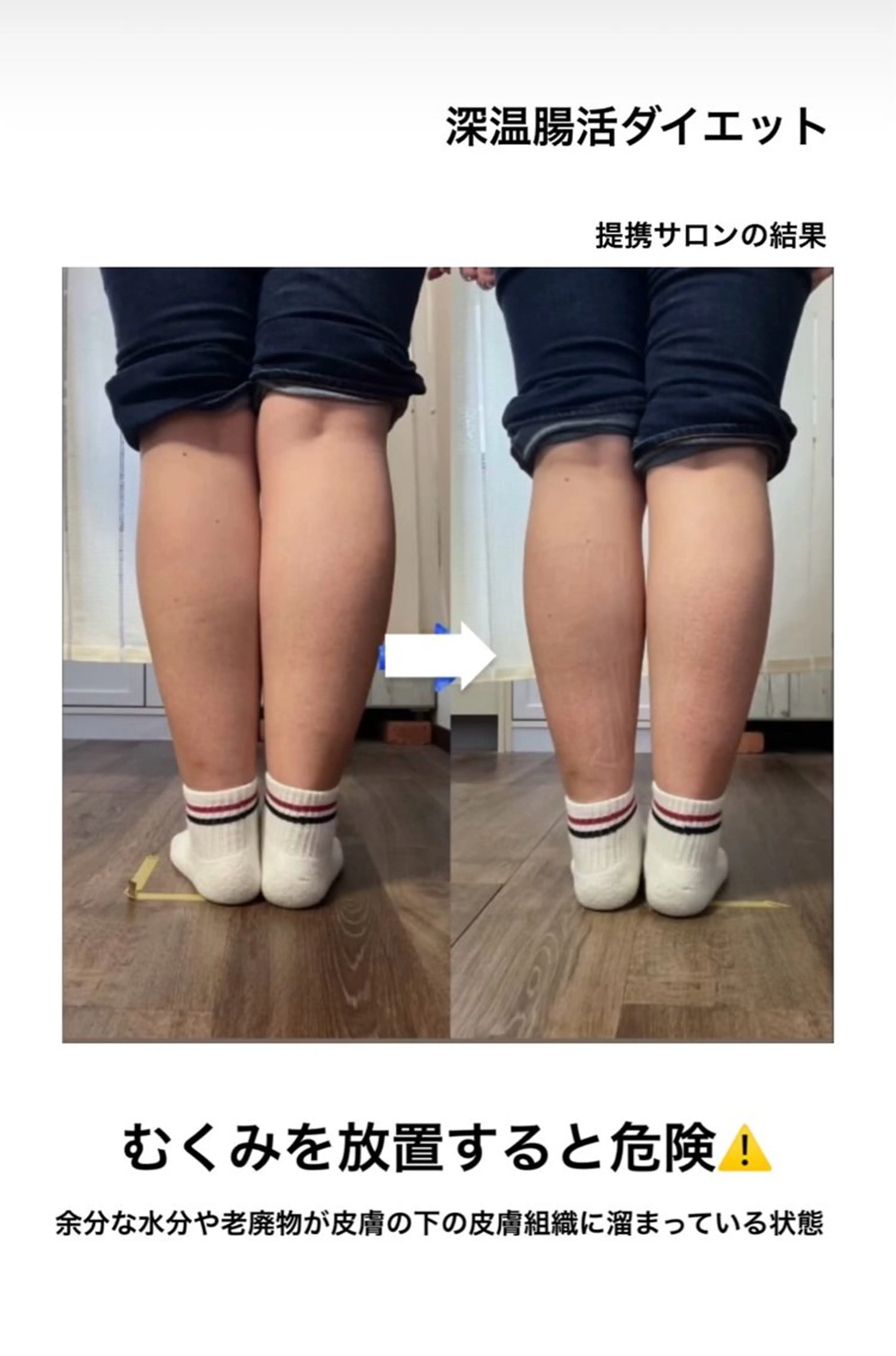 luana-ルアナ-所属・最高に輝く花嫁姿へ ブライダルsaronのエステ・リラクイメージ