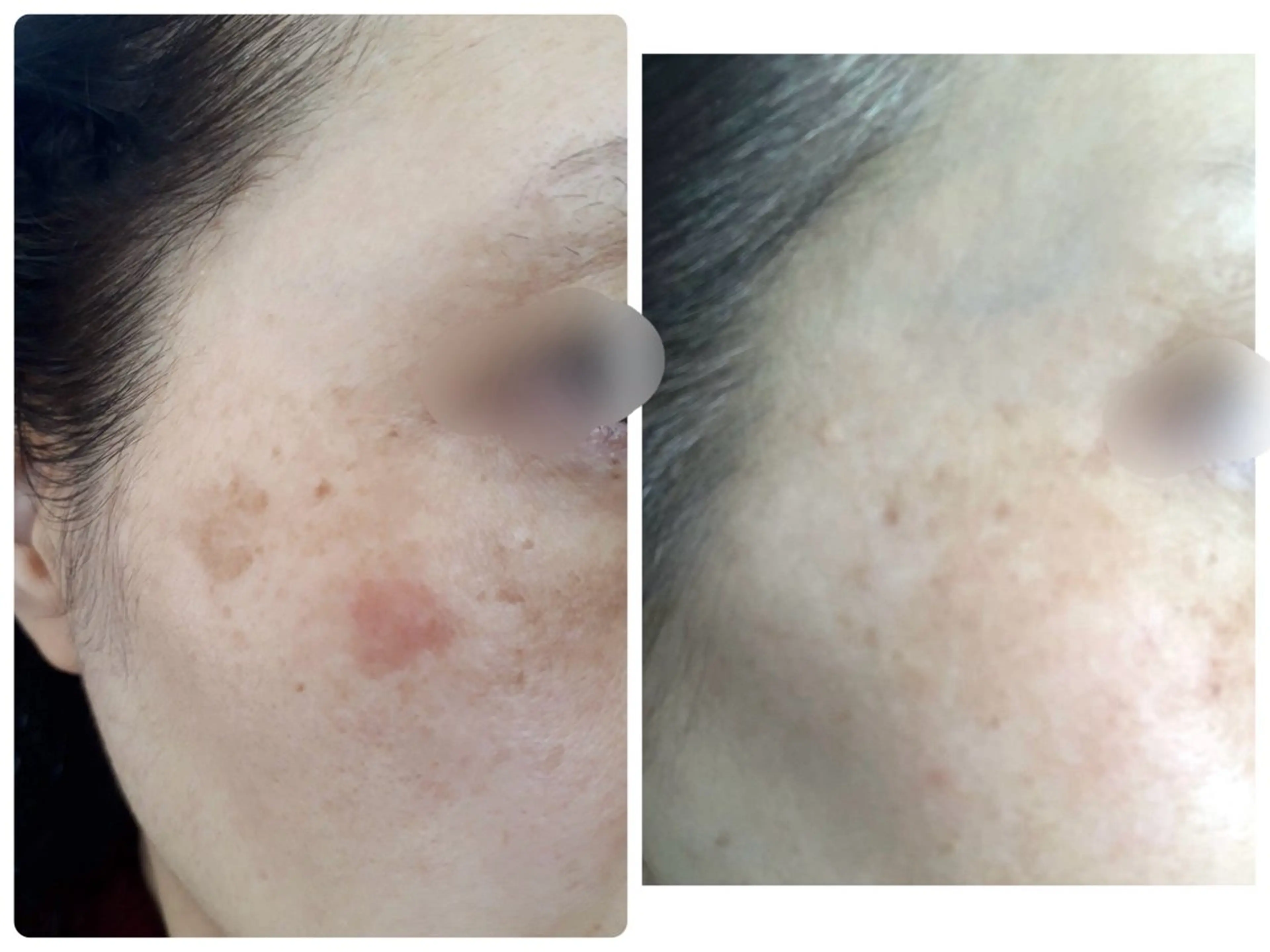 エステティックジュビランアンビエンテ福井店所属・ジュビラン 木村 紗也香のエステ・リラクイメージ