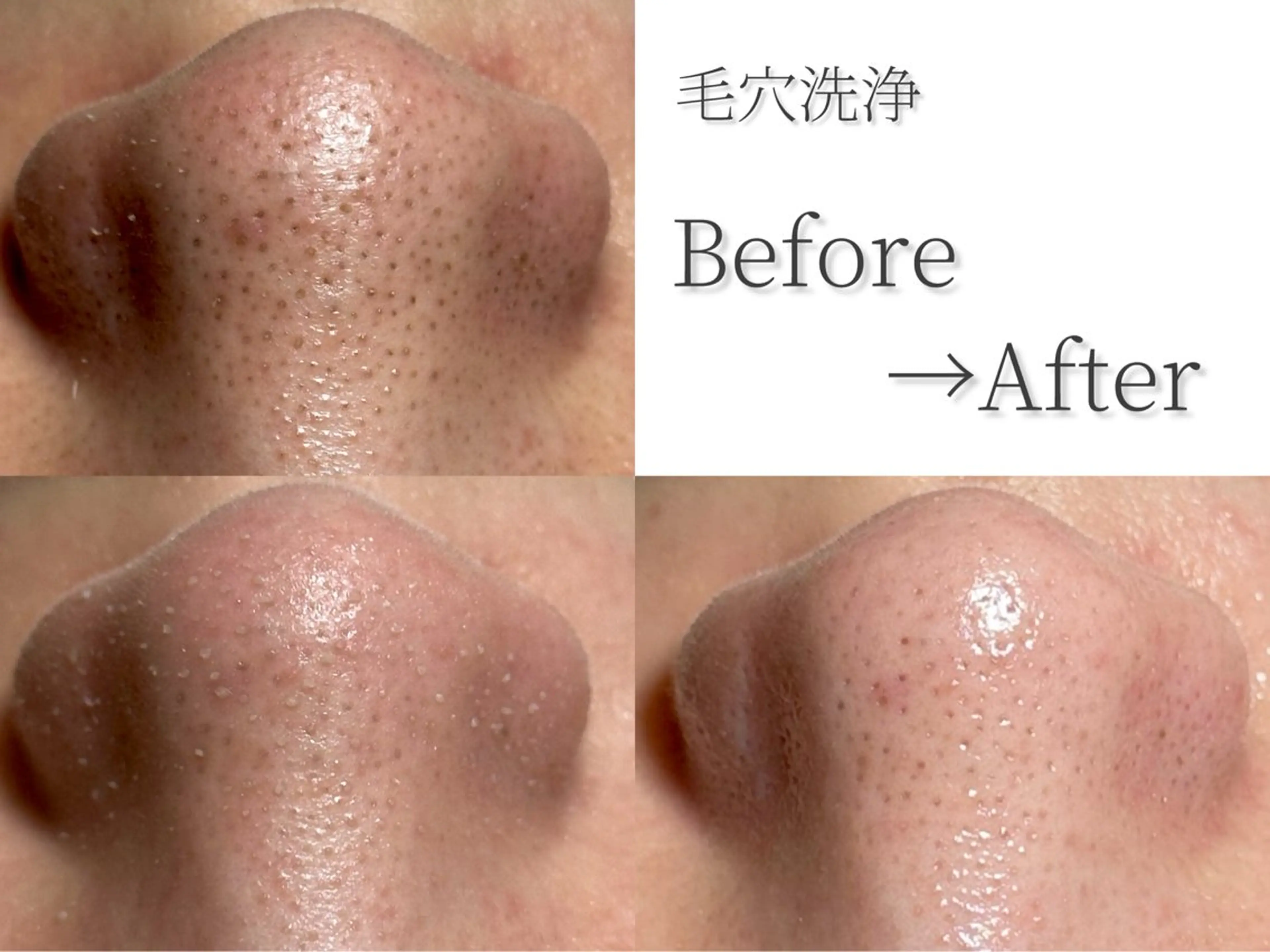 u-LALA by ROCHIE&MILLE TENDRESSES所属・☘️【極上リラク】 疲労回復アロマリンパのエステ・リラクイメージ